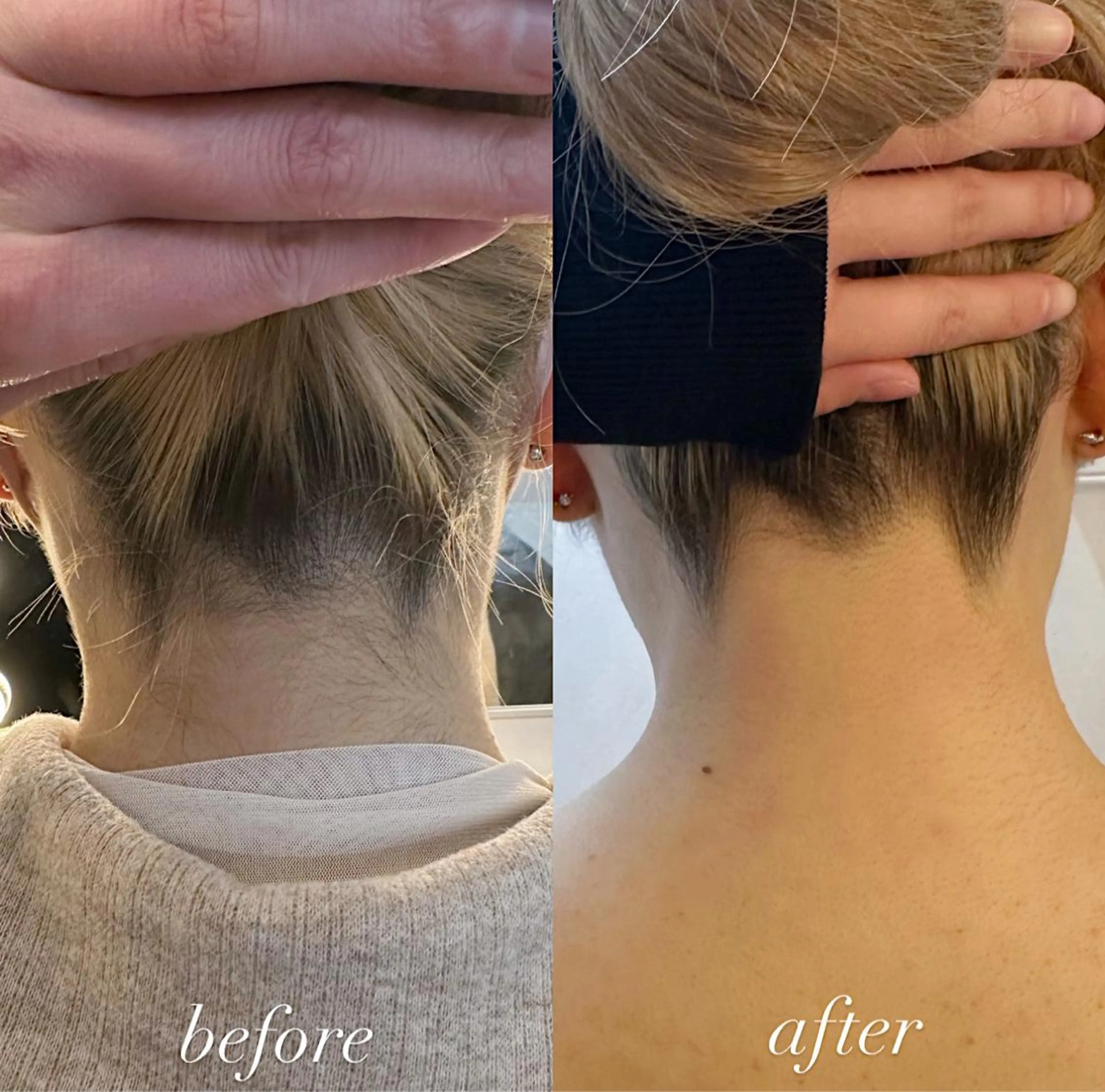 うなじ脱毛/美肌脱毛 LABELのエステ・リラクイメージ