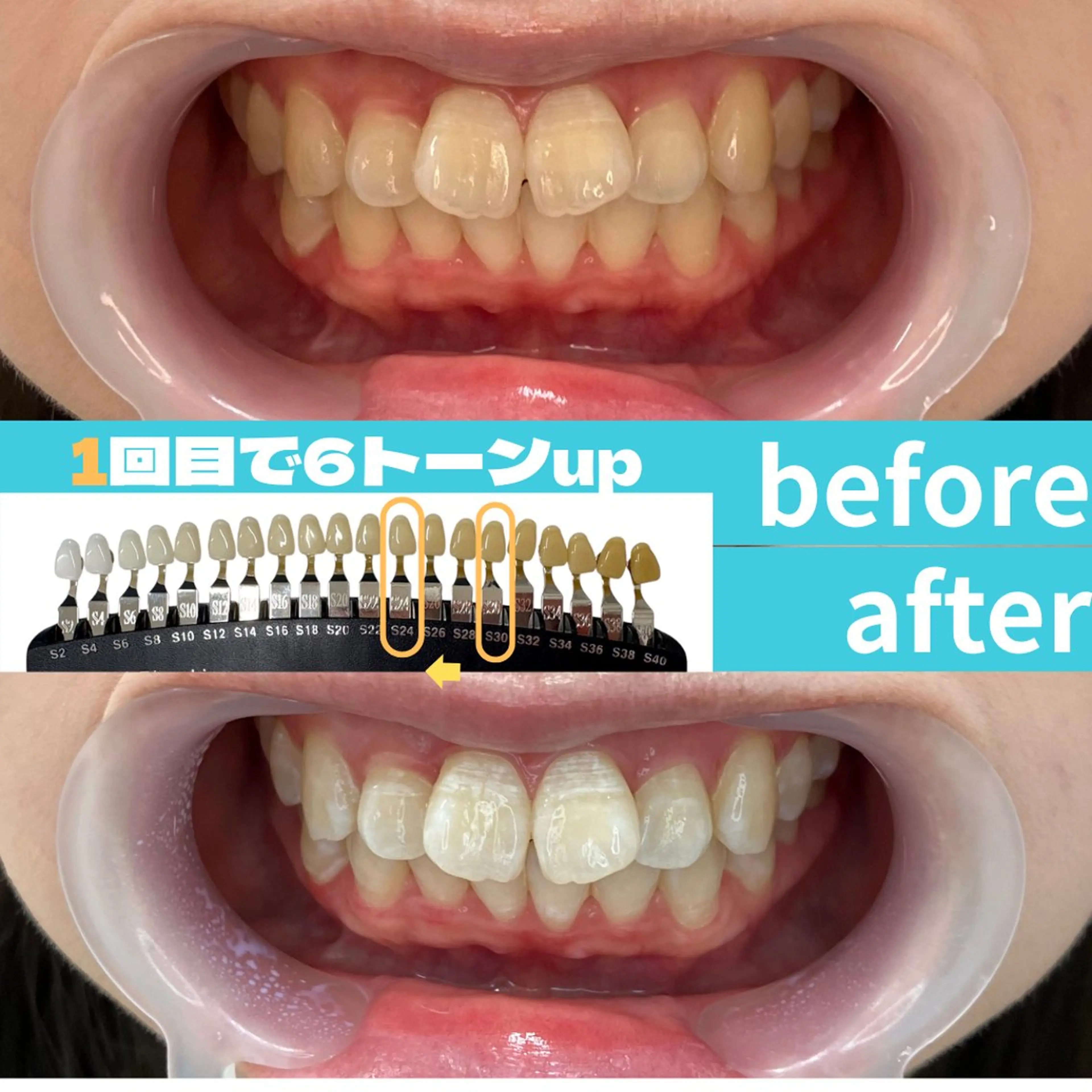 エステ s rikoのエステ・リラクイメージ