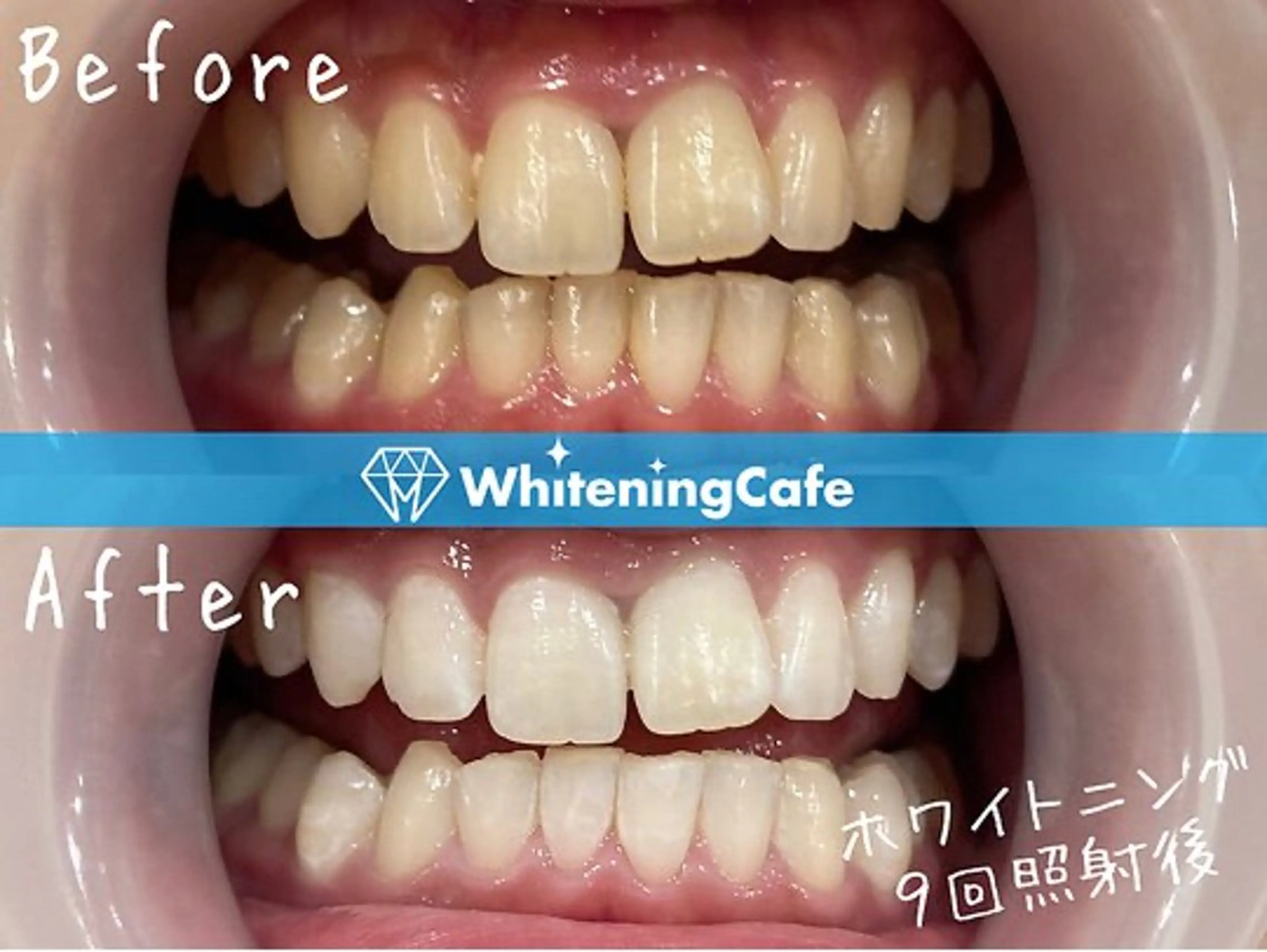 ホワイトニングカフェ 荻窪店のその他イメージ