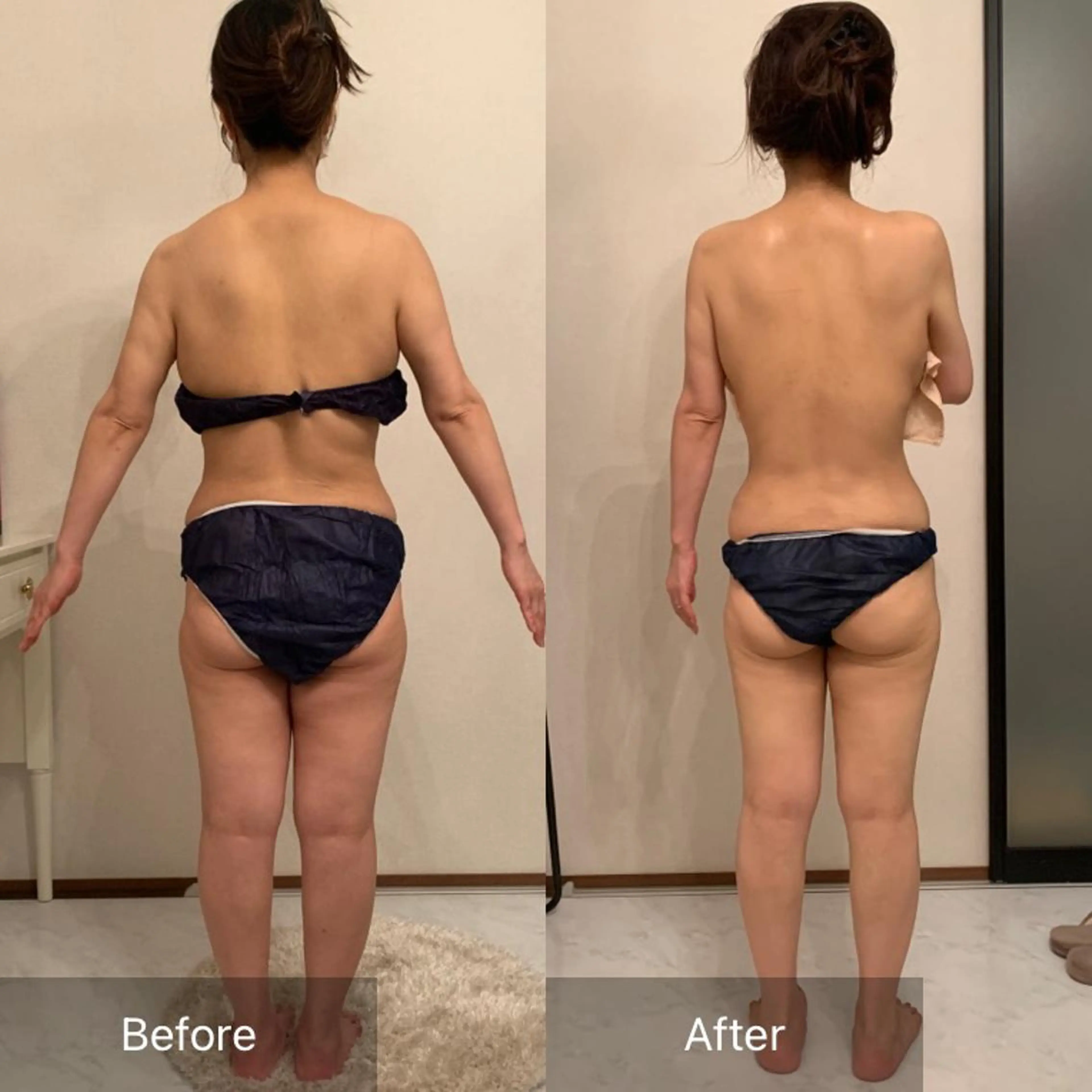 短期間でスッキリを目指したい方へ🌈🌻👙✨集中ボディケア🔥90分【モニター3回セット】¥72,000 →の写真