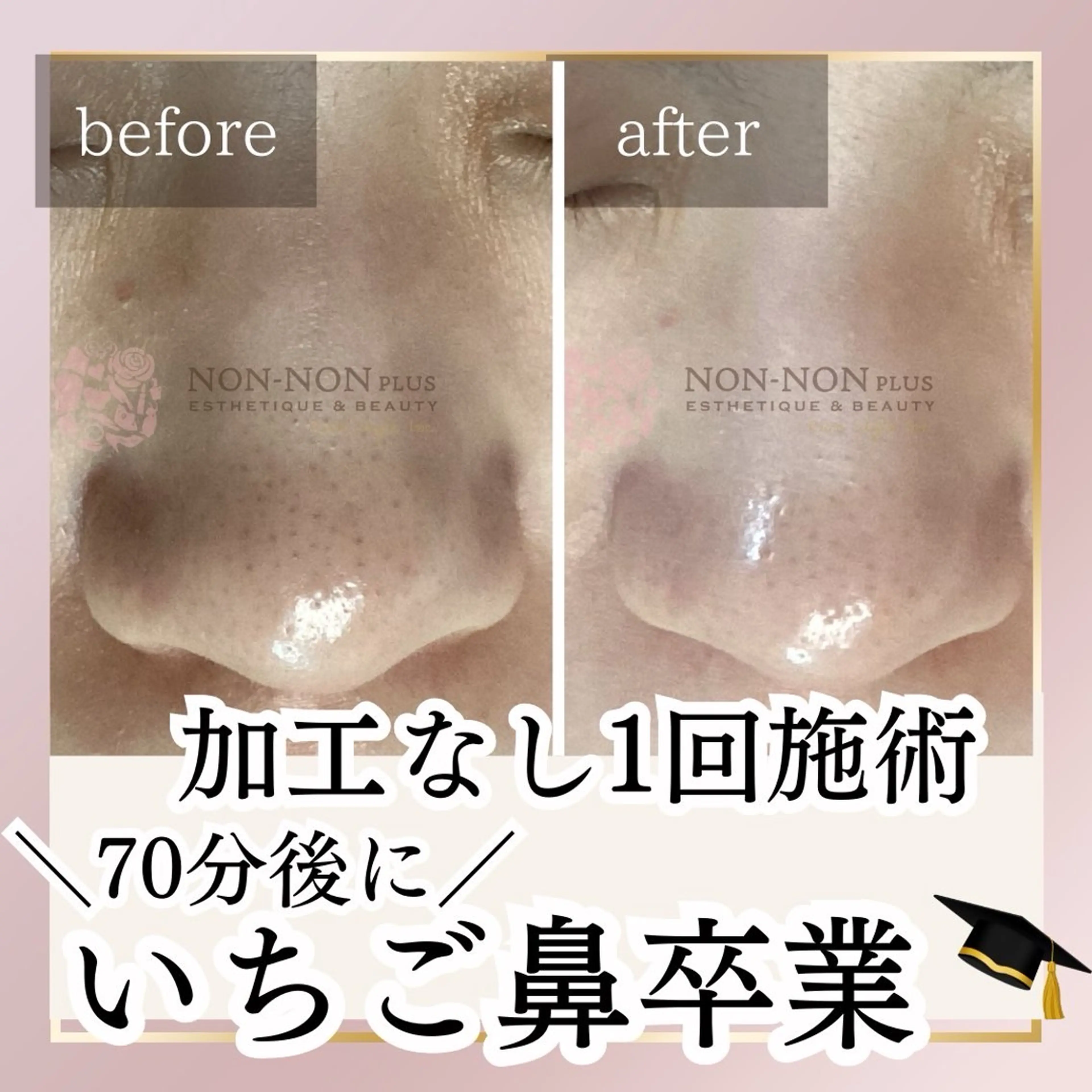 NON-NONプラス 大人の本気痩身のエステ・リラクイメージ