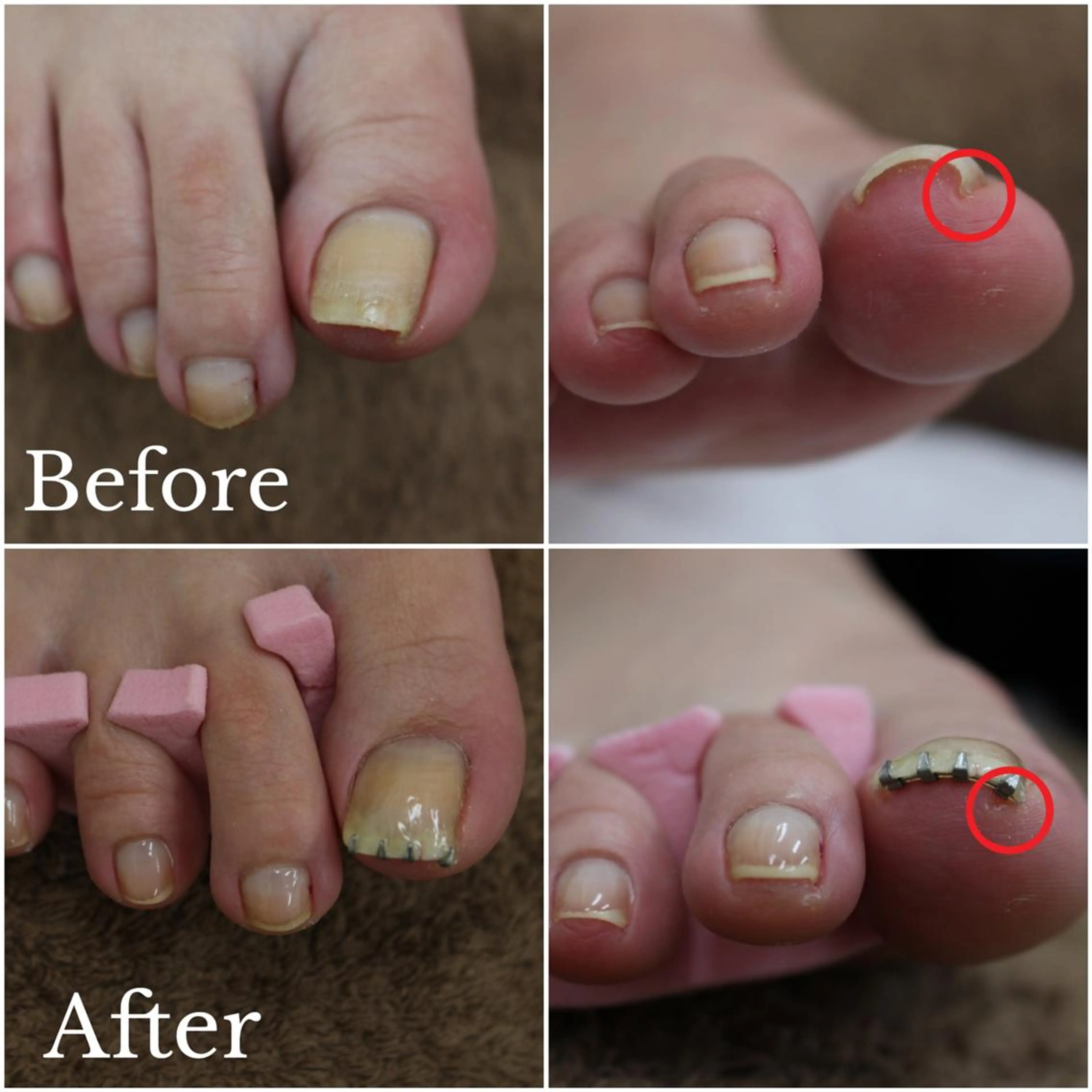 東 あきらのネイルデザイン