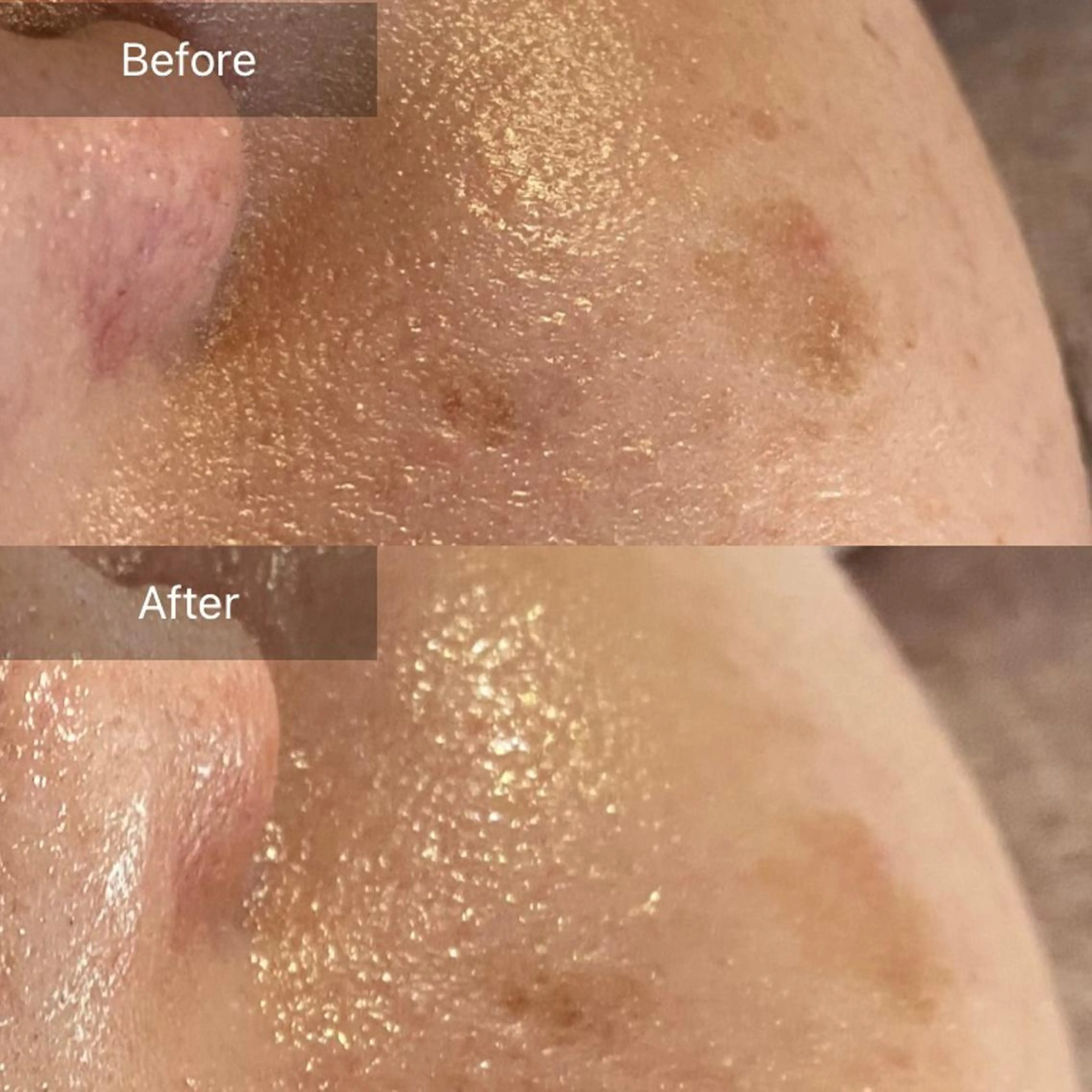 毛穴から始める肌メン テマンダリンオレンジのエステ・リラクイメージ