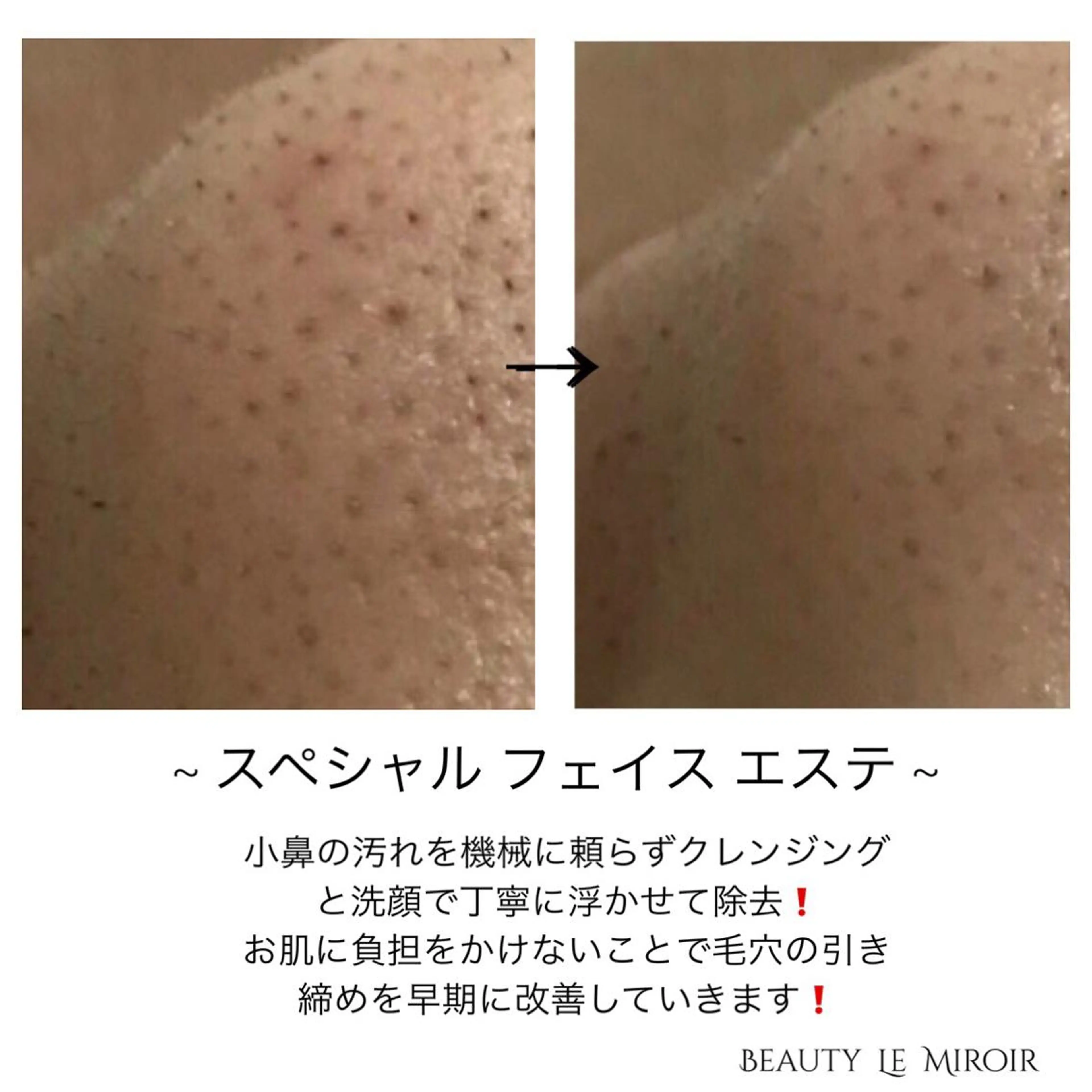 ビューティー ミロワールのエステ・リラクイメージ