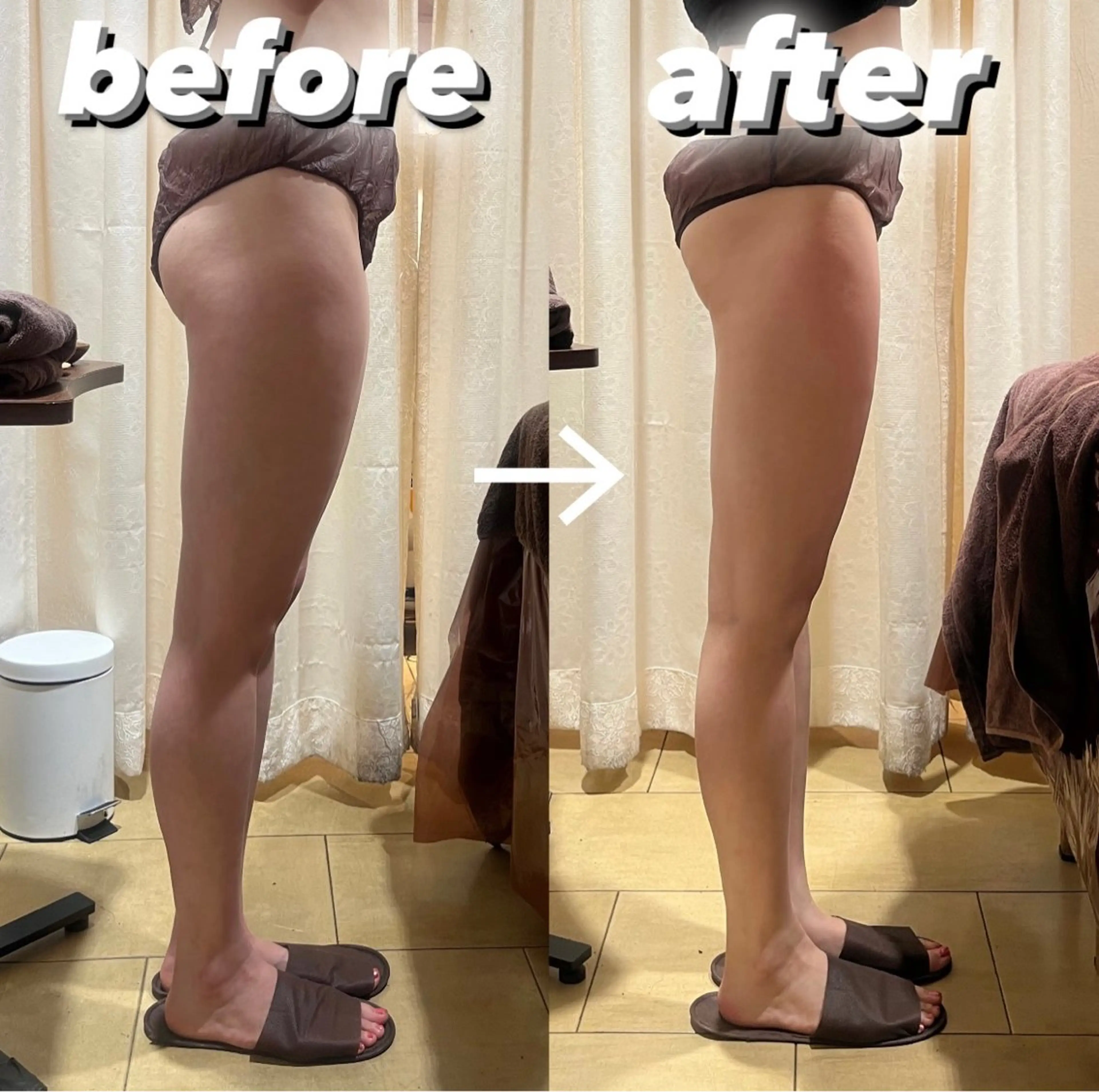 BeauL銀座 村浜友菜🤍のエステ・リラクイメージ