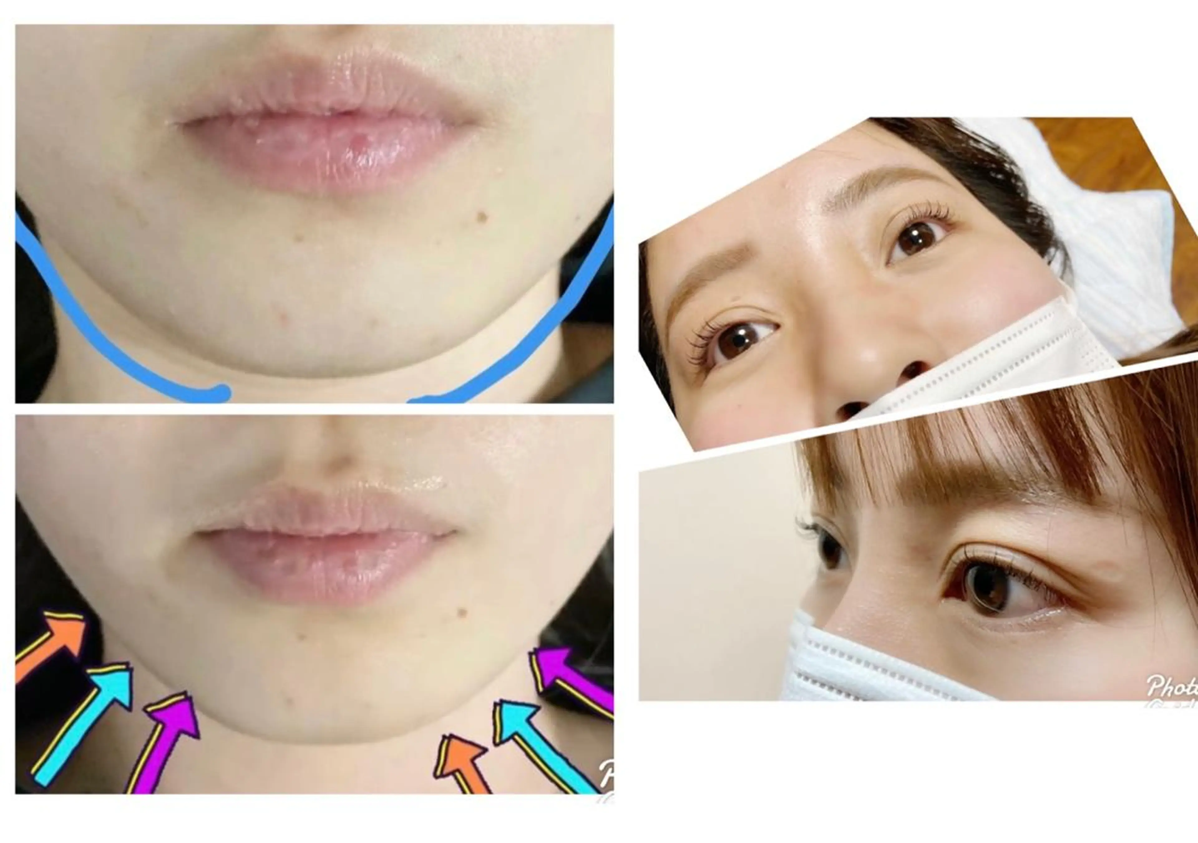 マツエク・マツパ 一重×まつ毛パーマ 森 陽子のマツエク・マツパデザイン