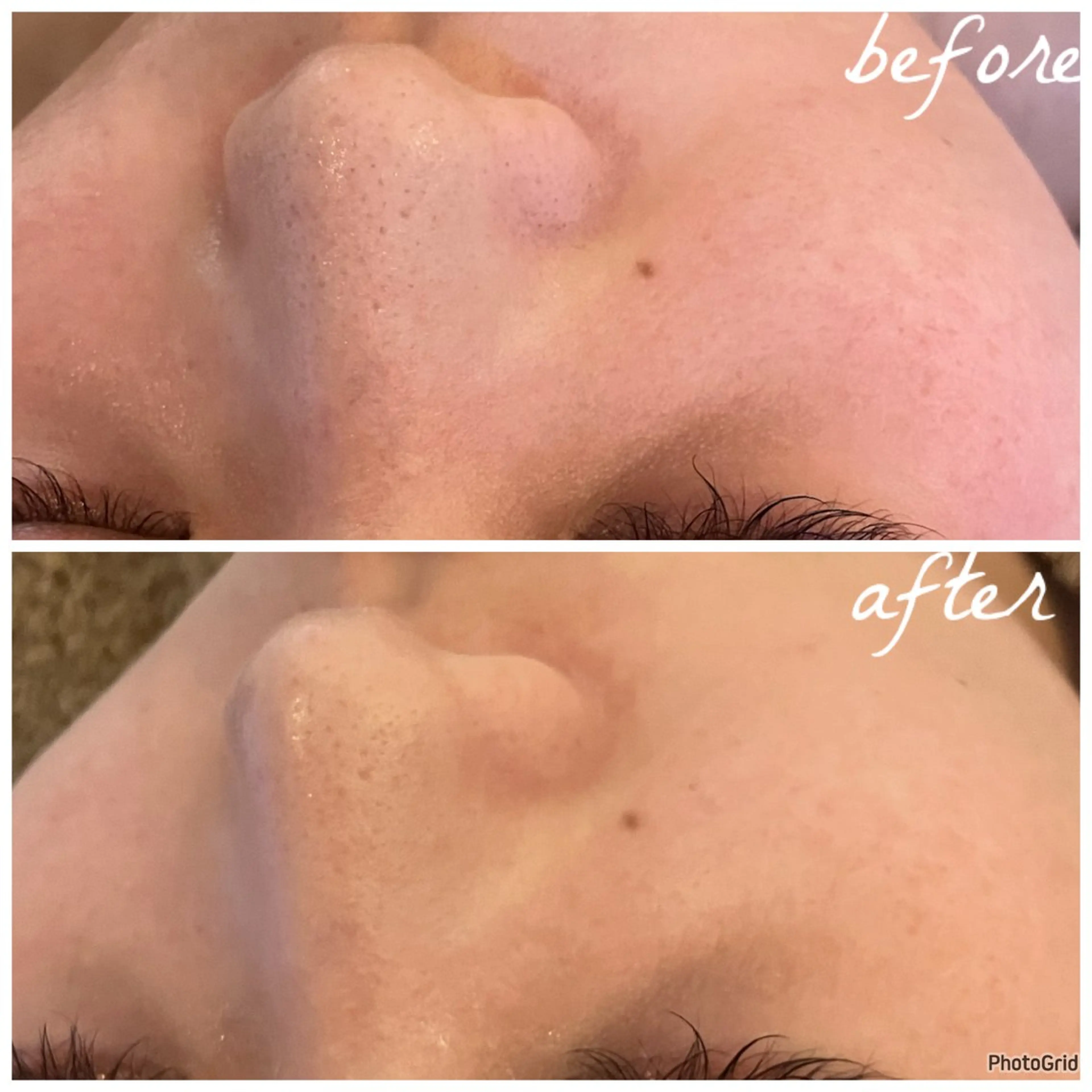 メンズ エステ メナード岐阜茜部 杉浦のエステ・リラクイメージ