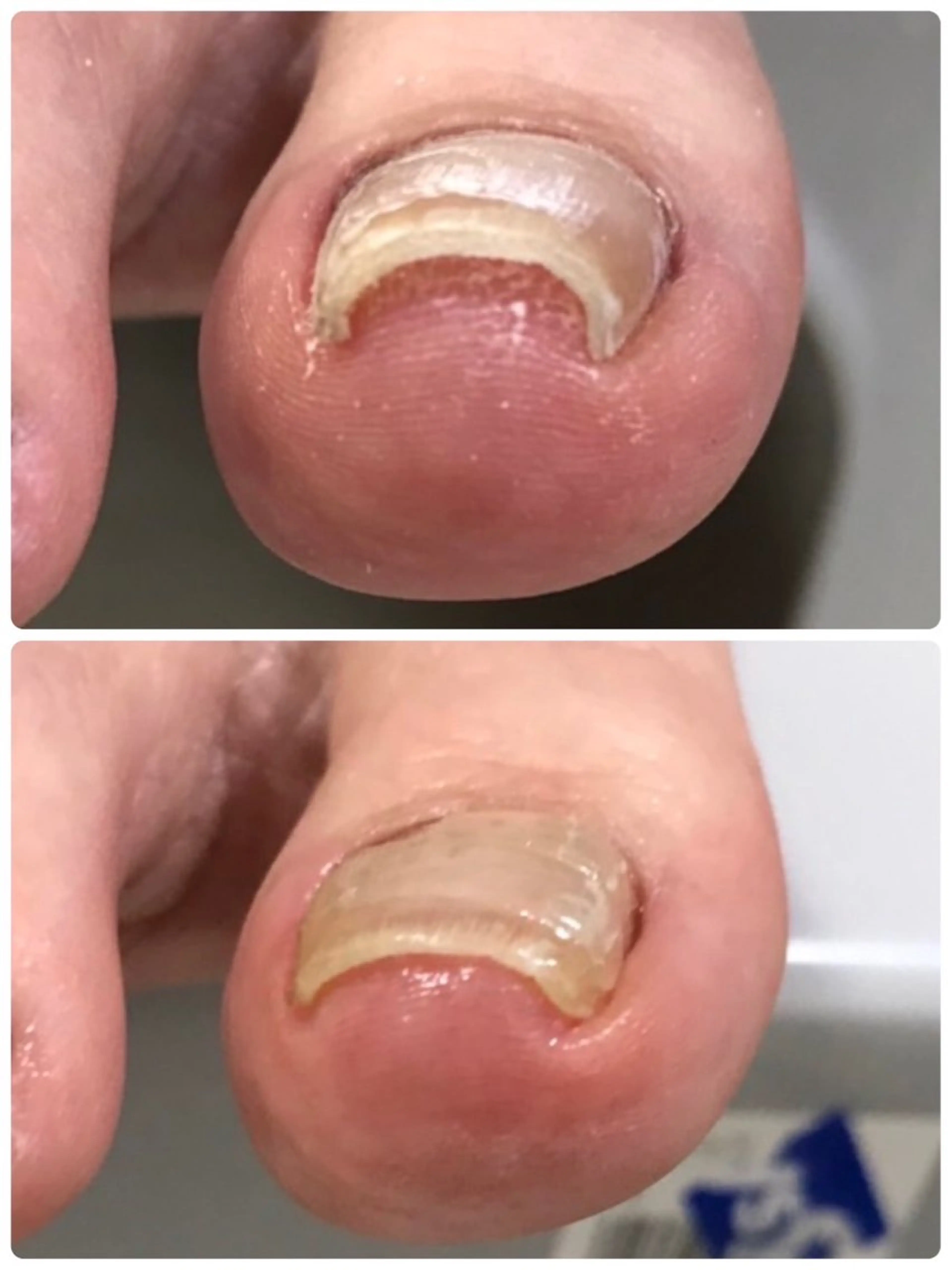 ネイル その他(ネイル) 丸山 萌奈のネイルデザイン