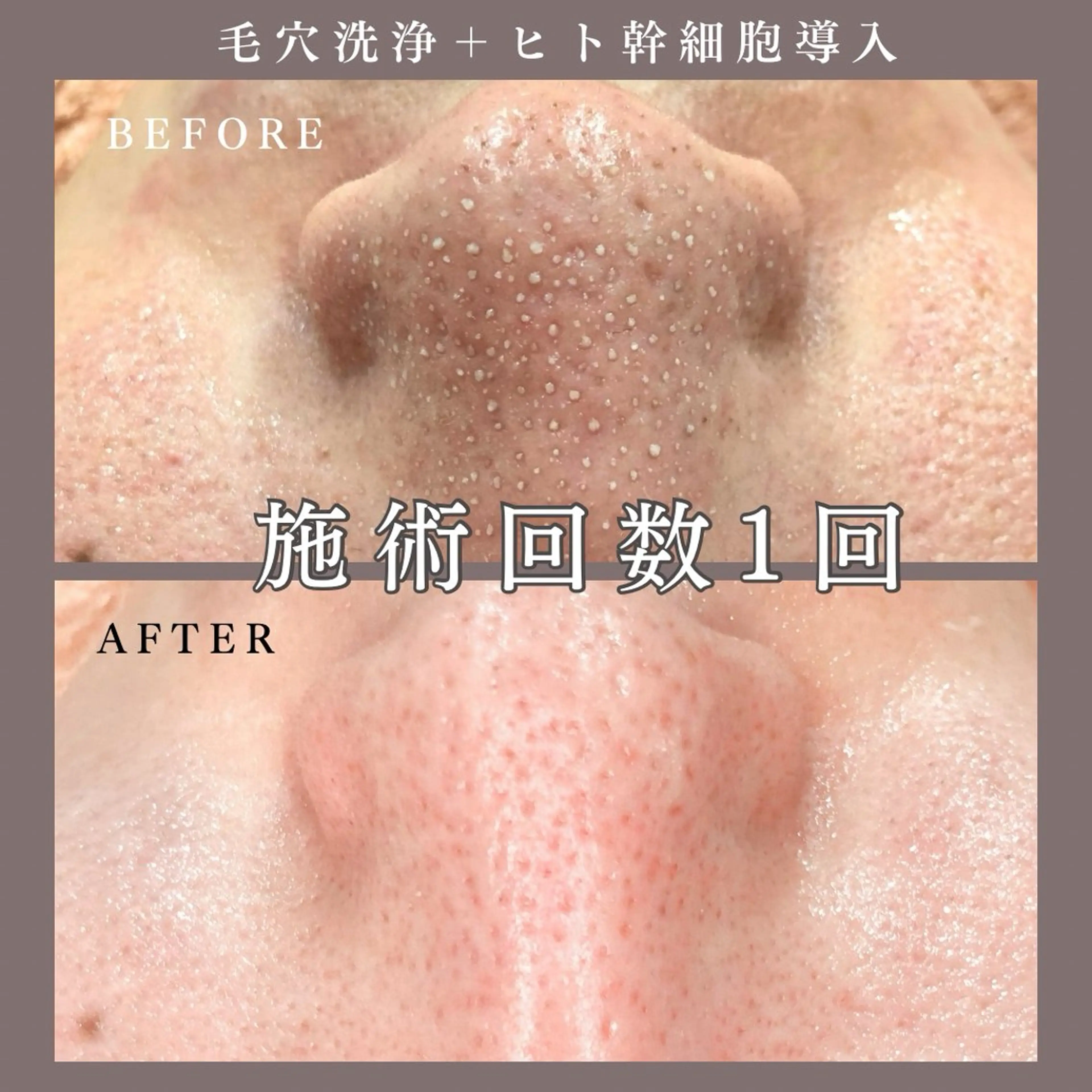 エステ 肌質改善専門サロン Bellmi/心斎橋のエステ・リラクイメージ