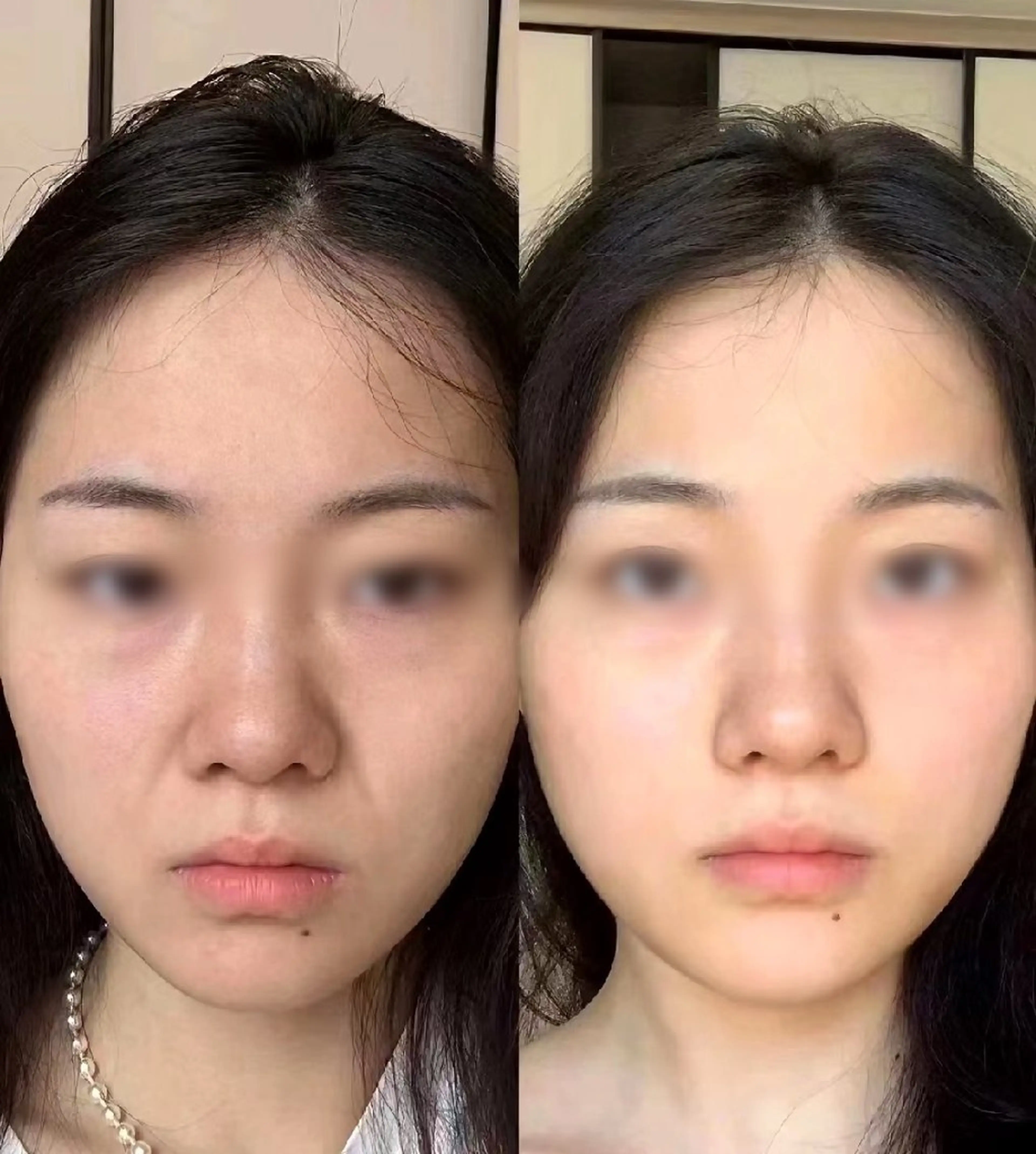 aliaハーブ水光店 エステティシャン募集のエステ・リラクイメージ