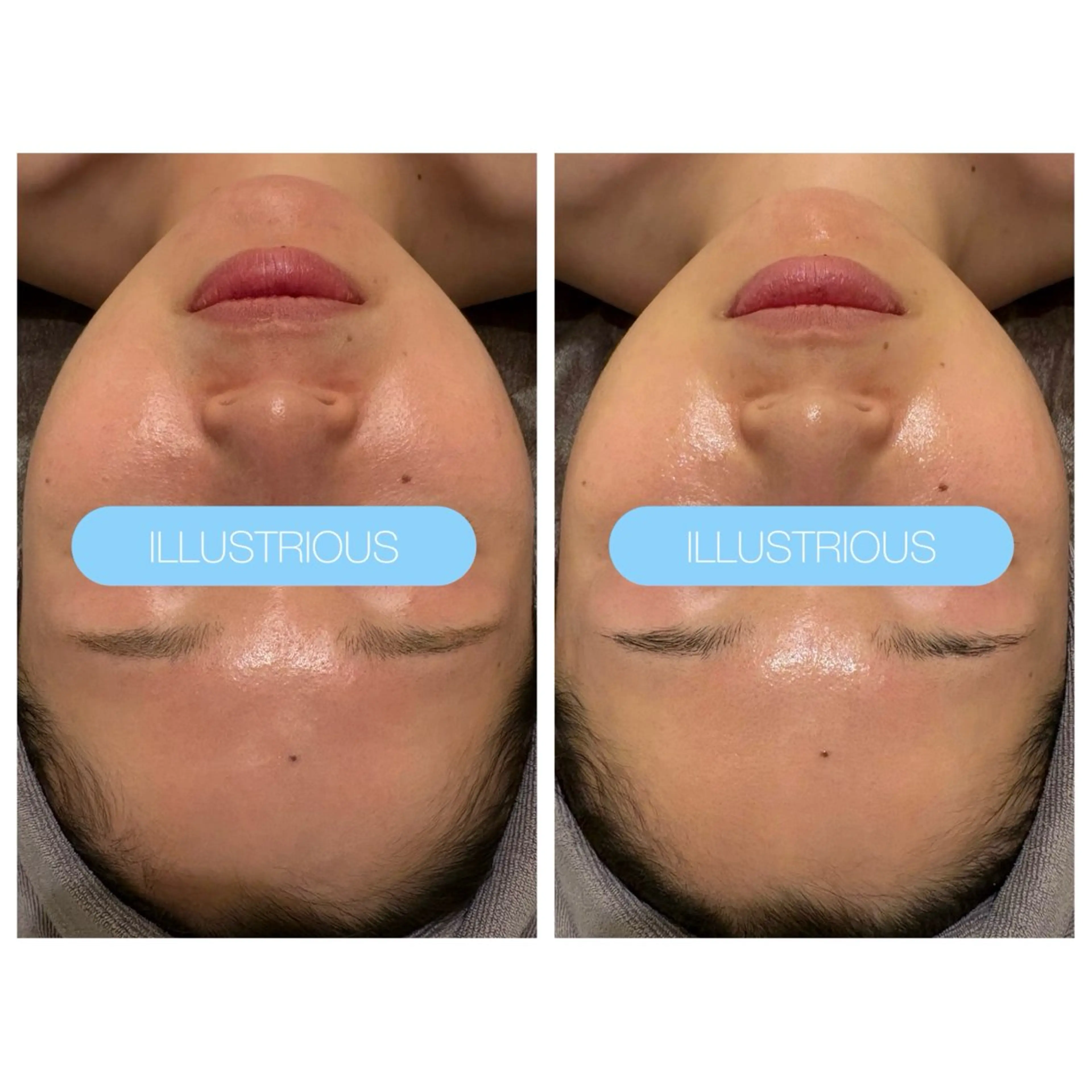 小顔コルギ ☆表参道/外苑前のエステ・リラクイメージ