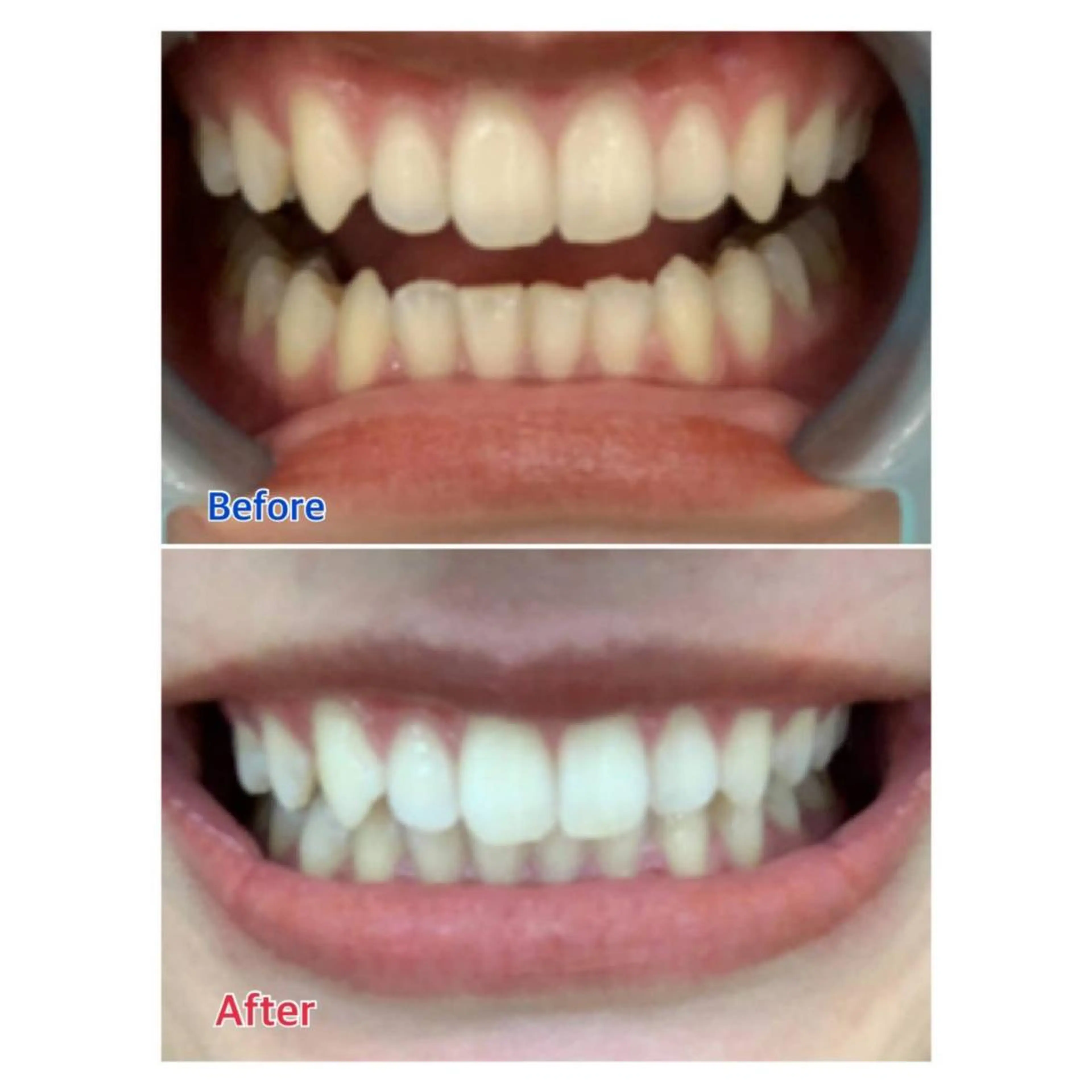 Melty 輝のその他イメージ