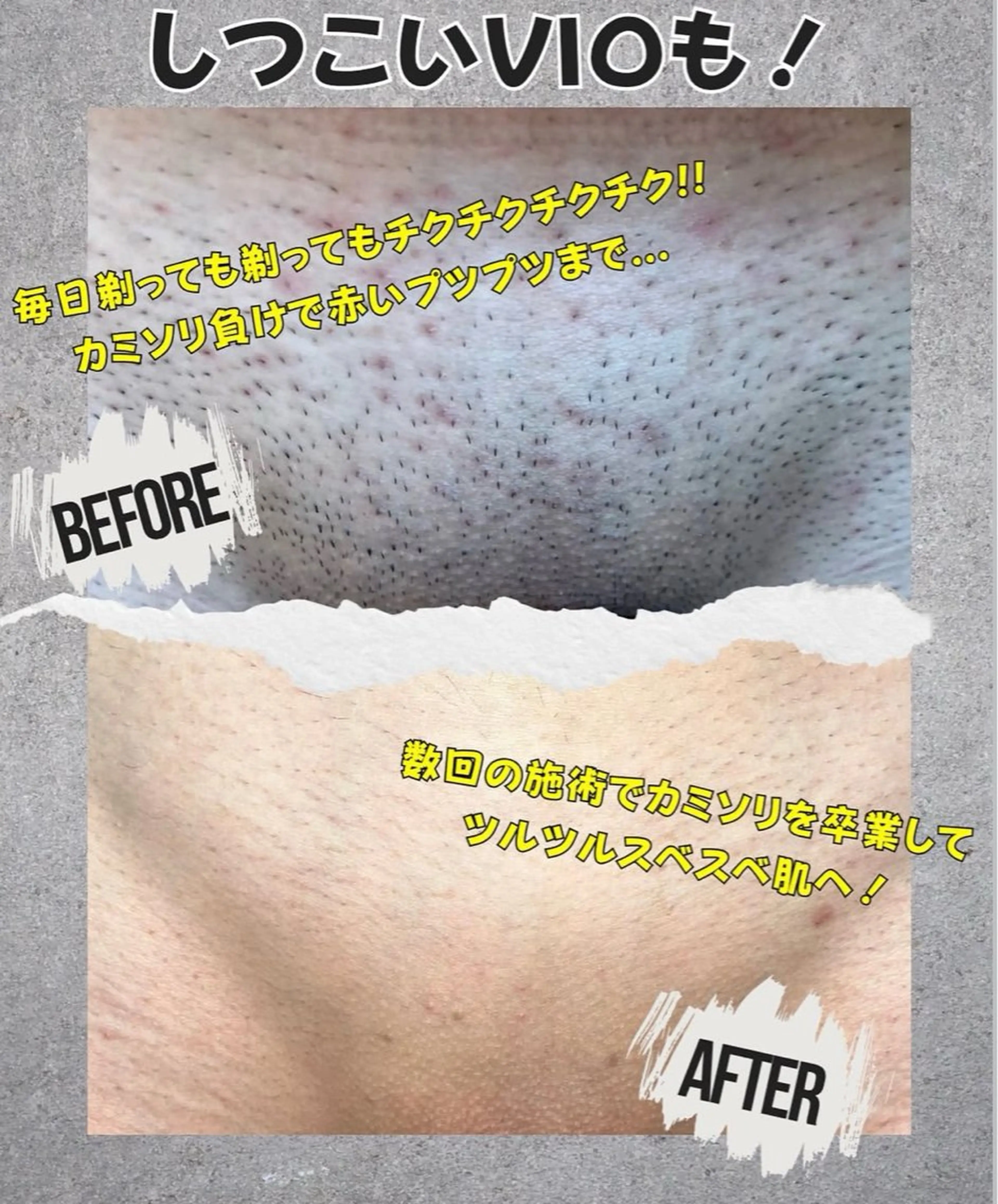 メンズ 脱毛 Neosalon ネオサロンのエステ・リラクイメージ
