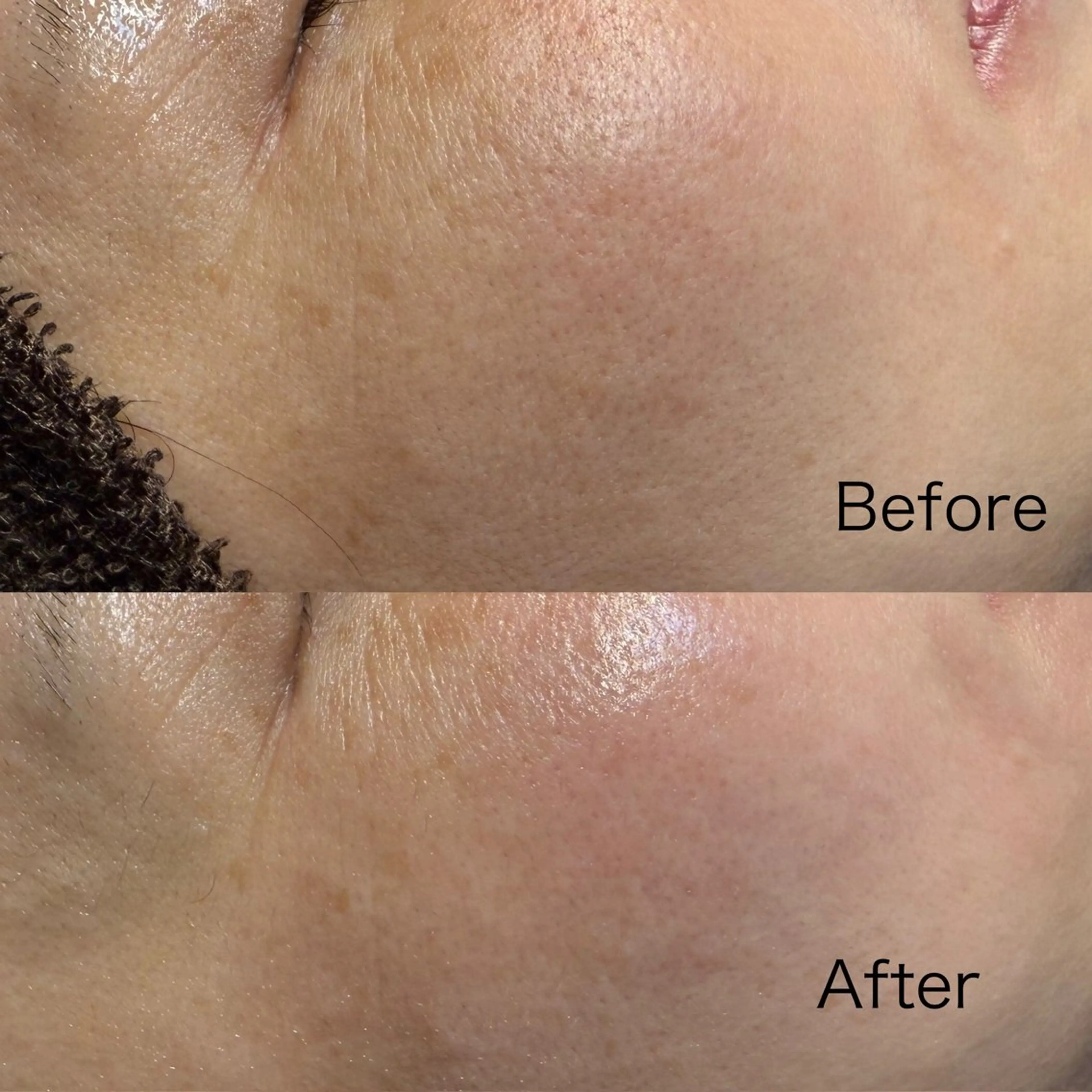 エステ Lala Beautyのエステ・リラクイメージ