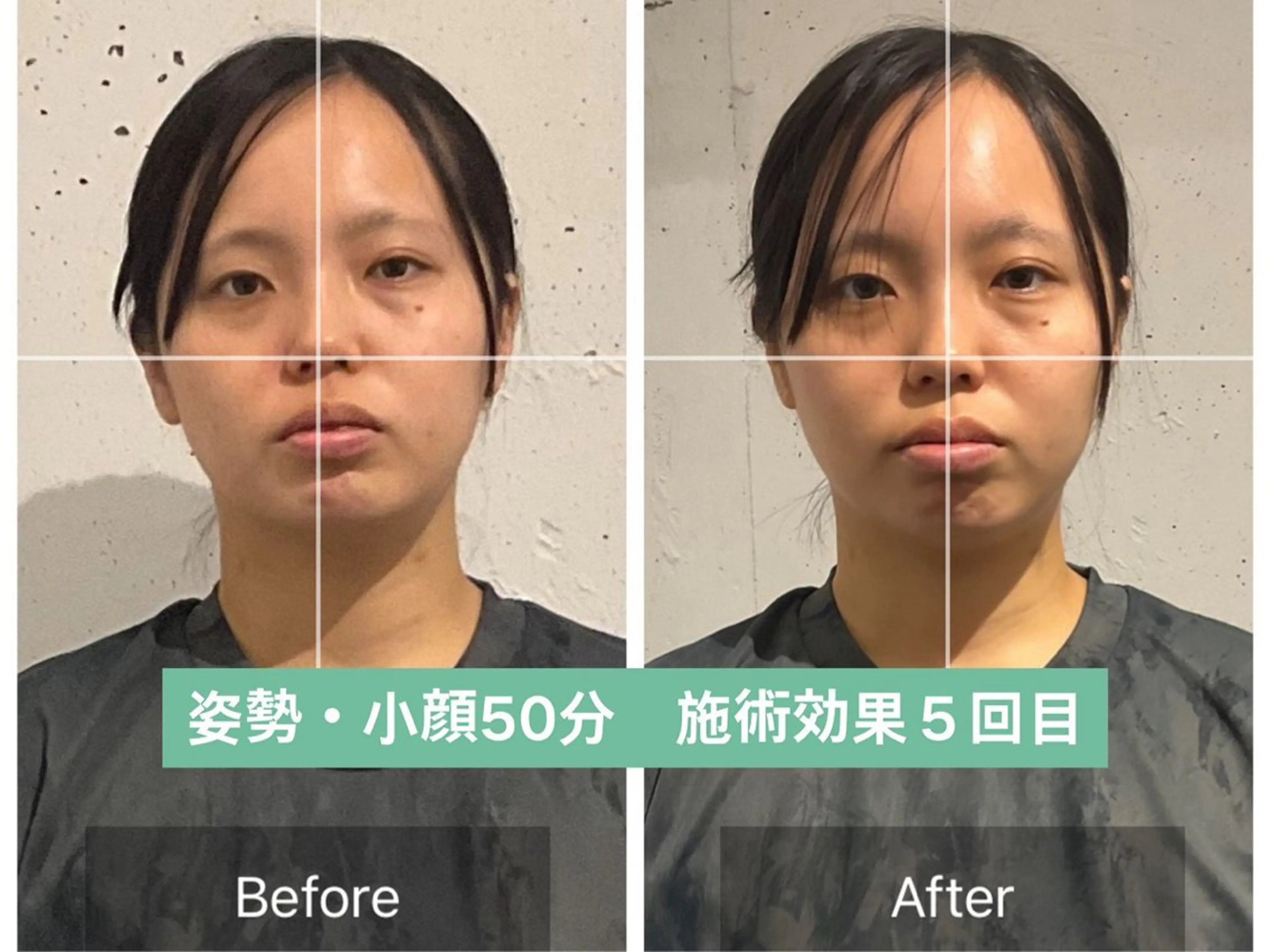 【歪み改善人気No.1】顔の歪み左右差＆小顔矯正+姿勢矯正【50分17900→2900】※先着3名の写真