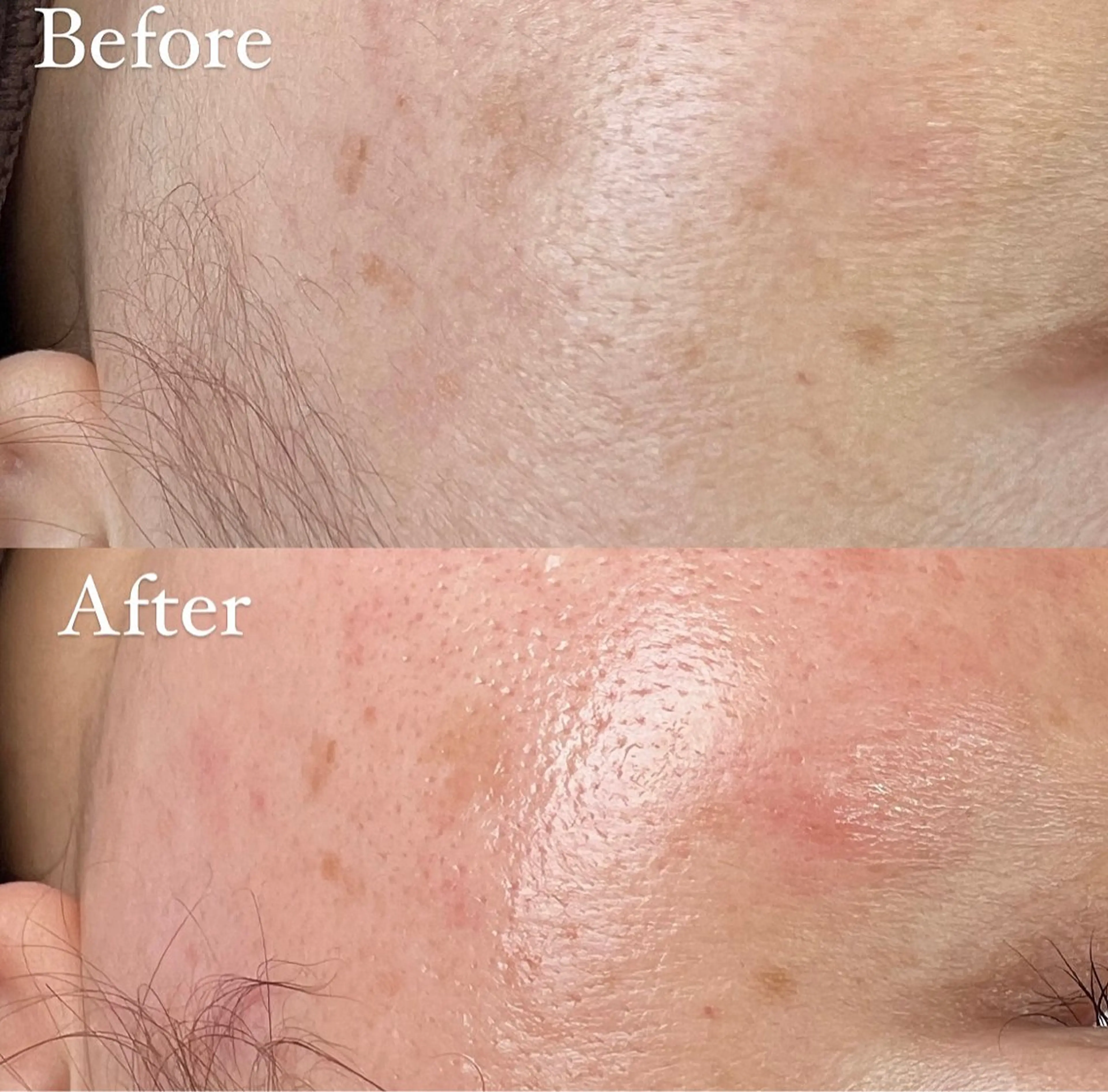 脱毛 丸山 彩乃のエステ・リラクイメージ