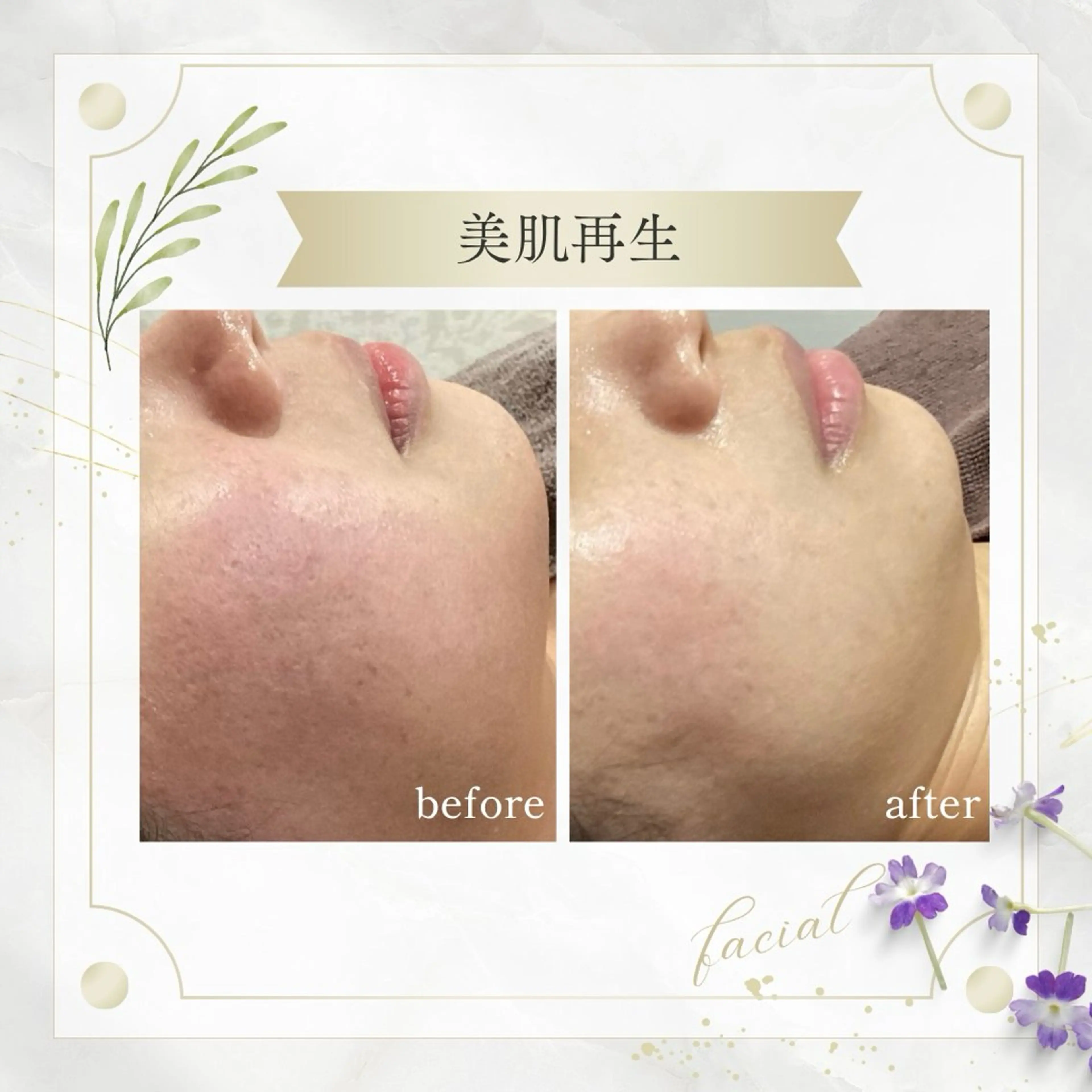 《 肌質×美肌 》 addissimoのエステ・リラクイメージ