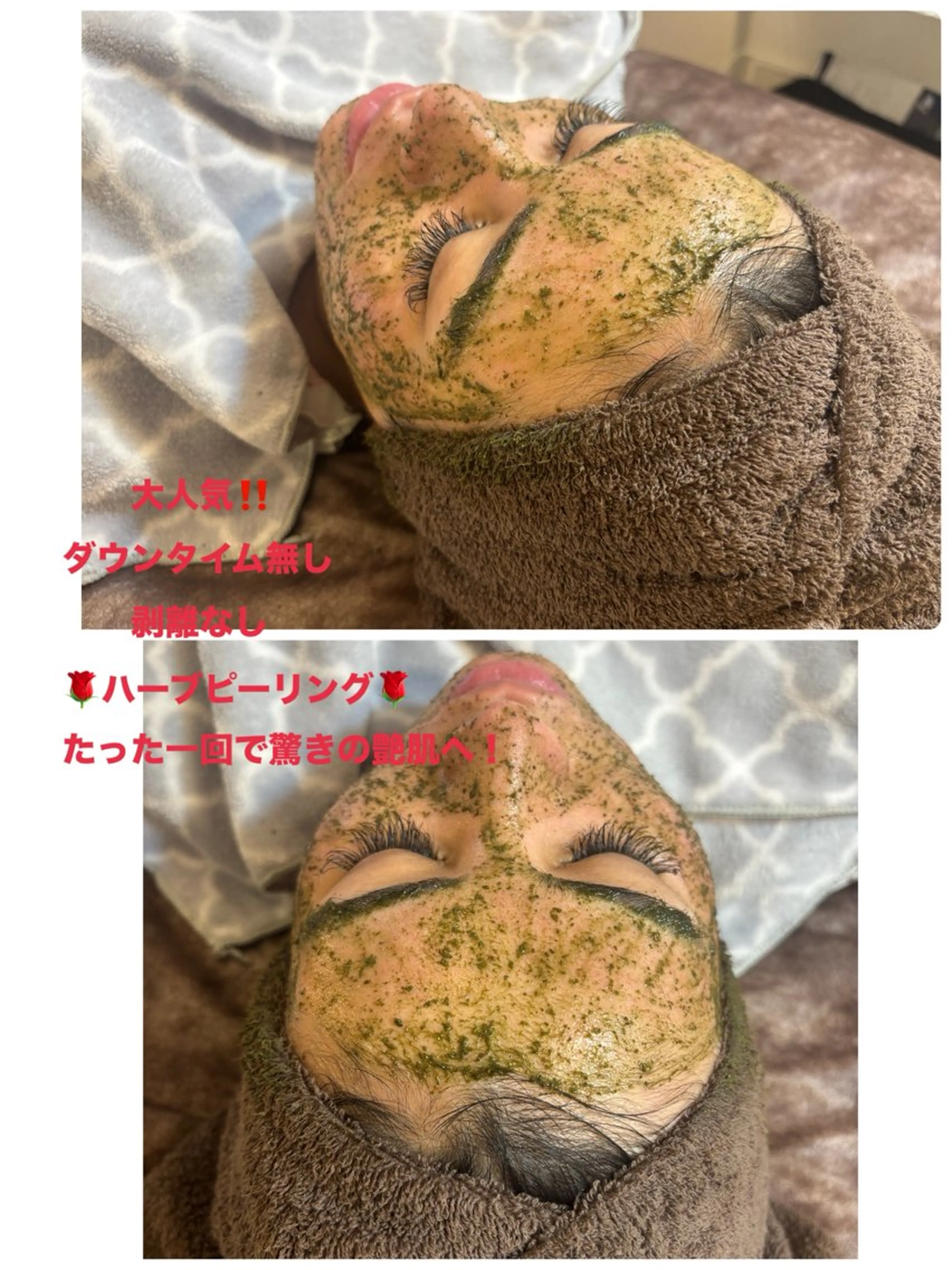 エステ ハーブピーリング専門 毛穴洗浄❤️眉waxのエステ・リラクイメージ