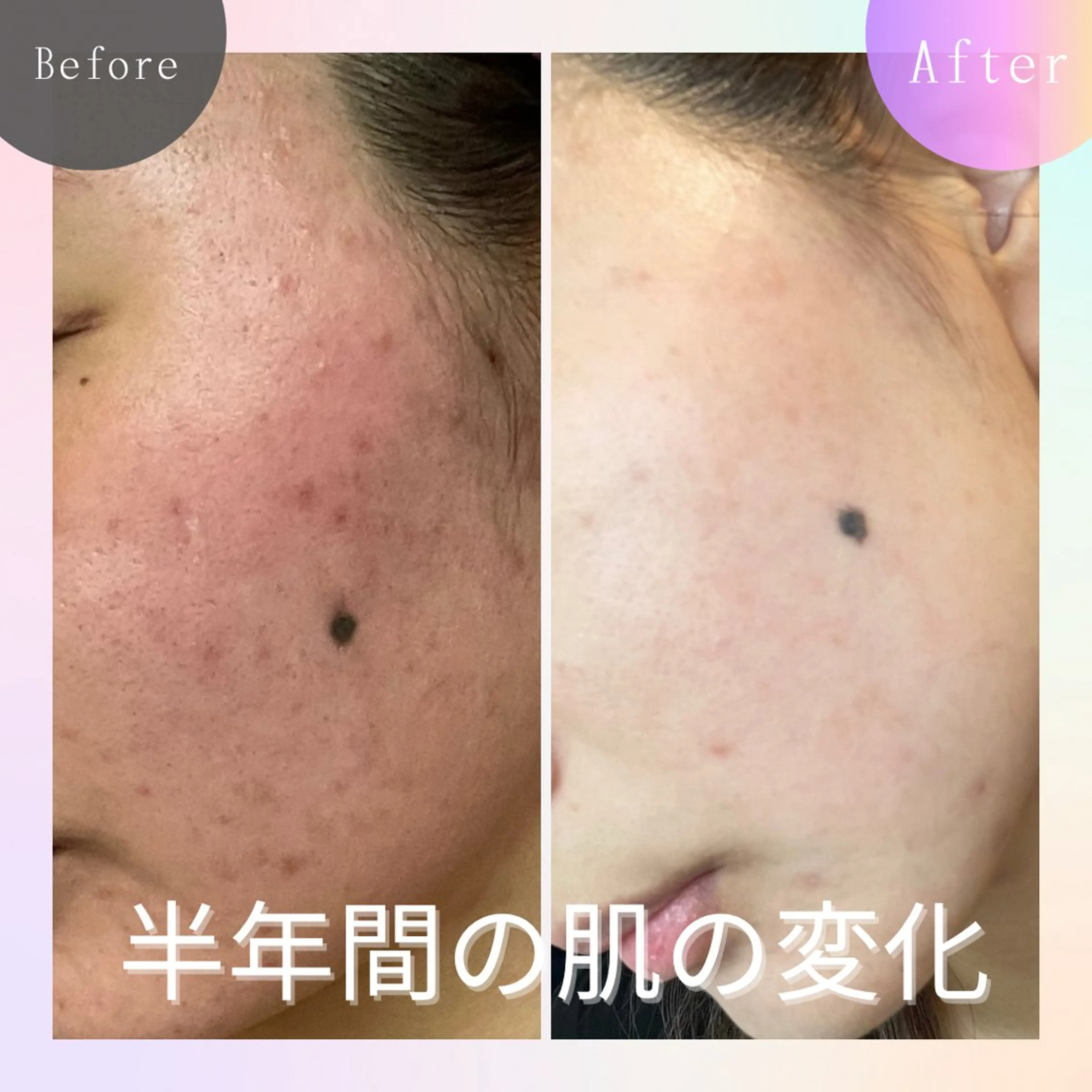 毛穴改善サロン d'Alba大阪住吉のエステ・リラクイメージ