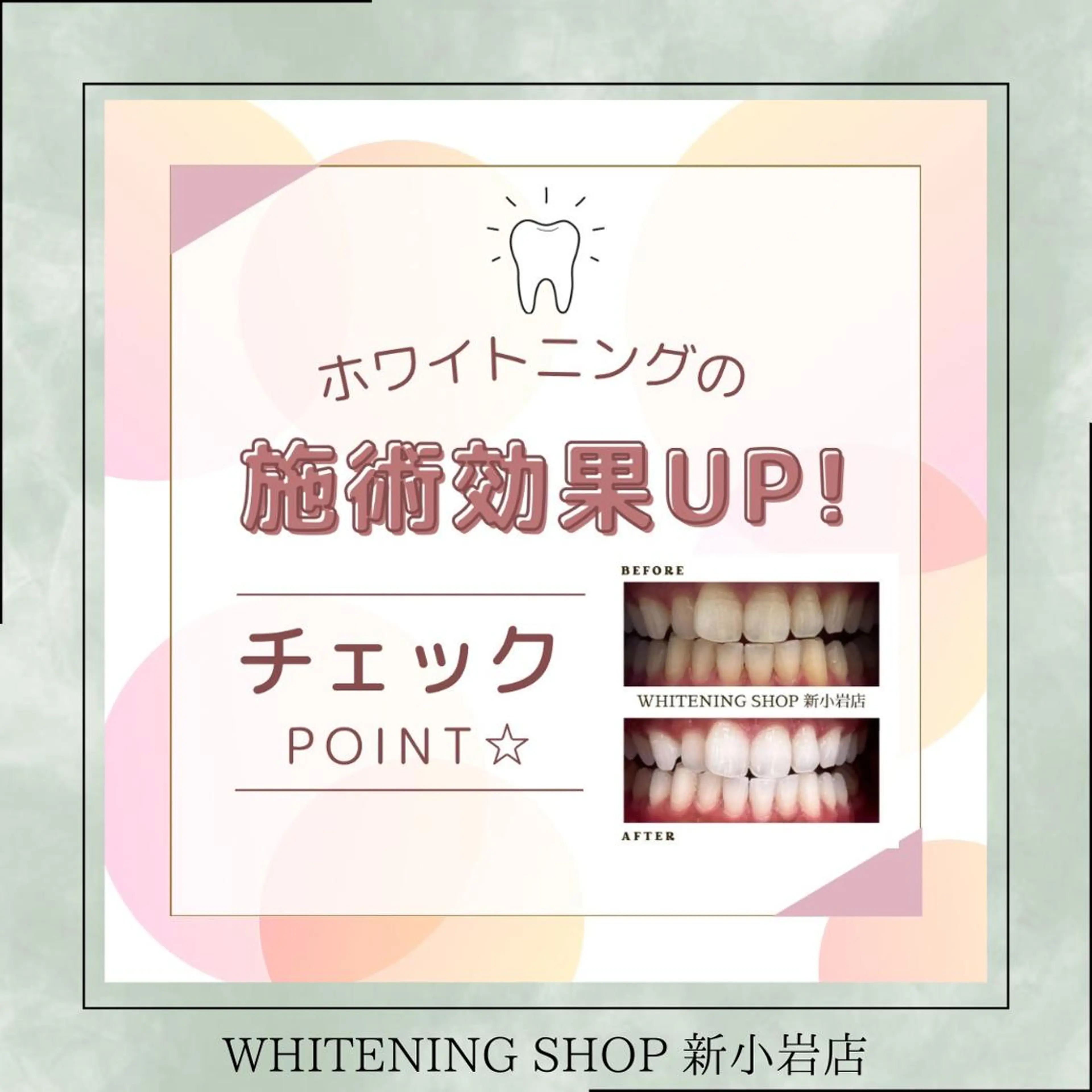 メンズ その他 ホワイトニング ショップ新小岩店のその他イメージ