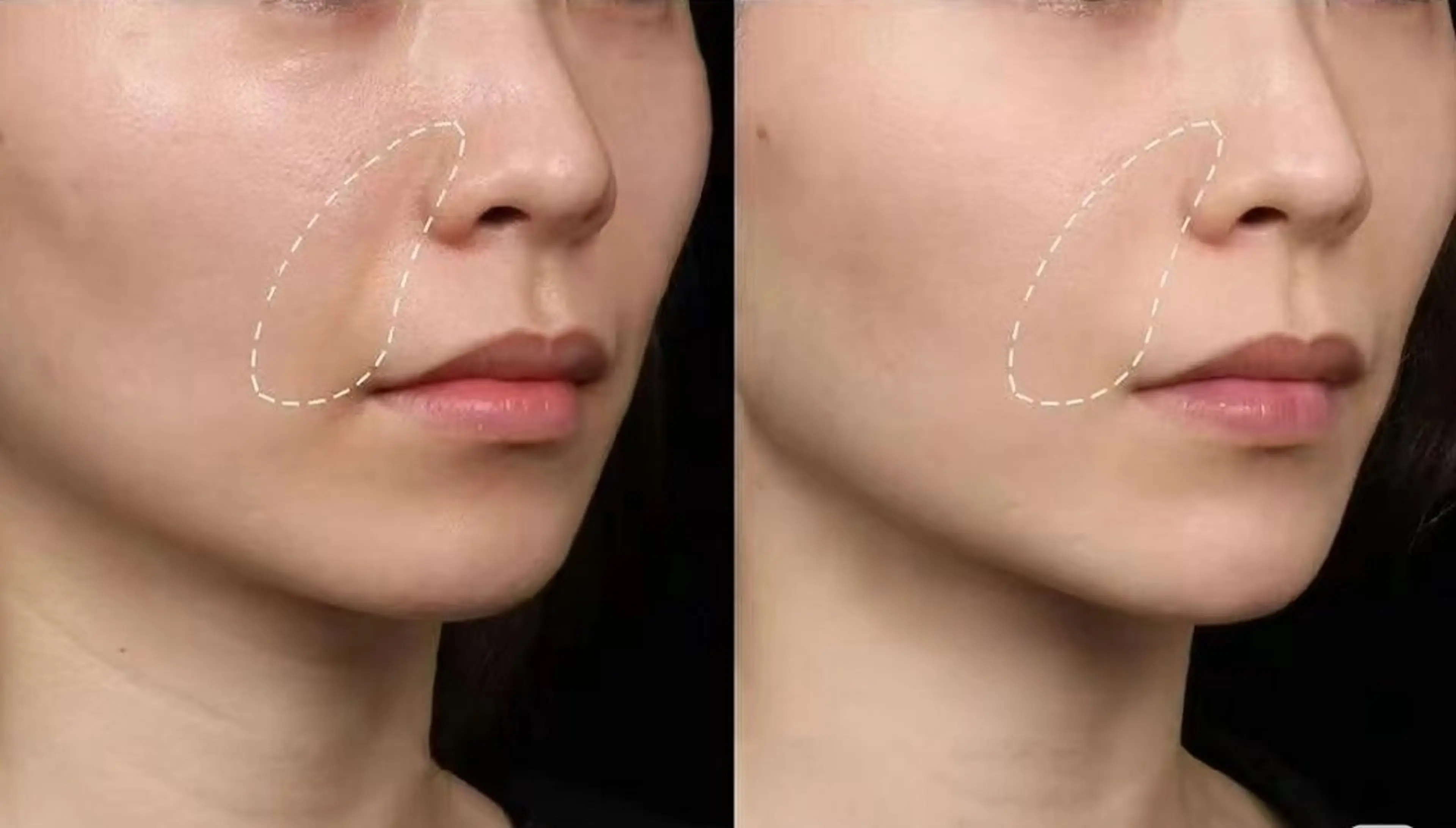 aliaハーブ水光店 エステティシャン募集のエステ・リラクイメージ