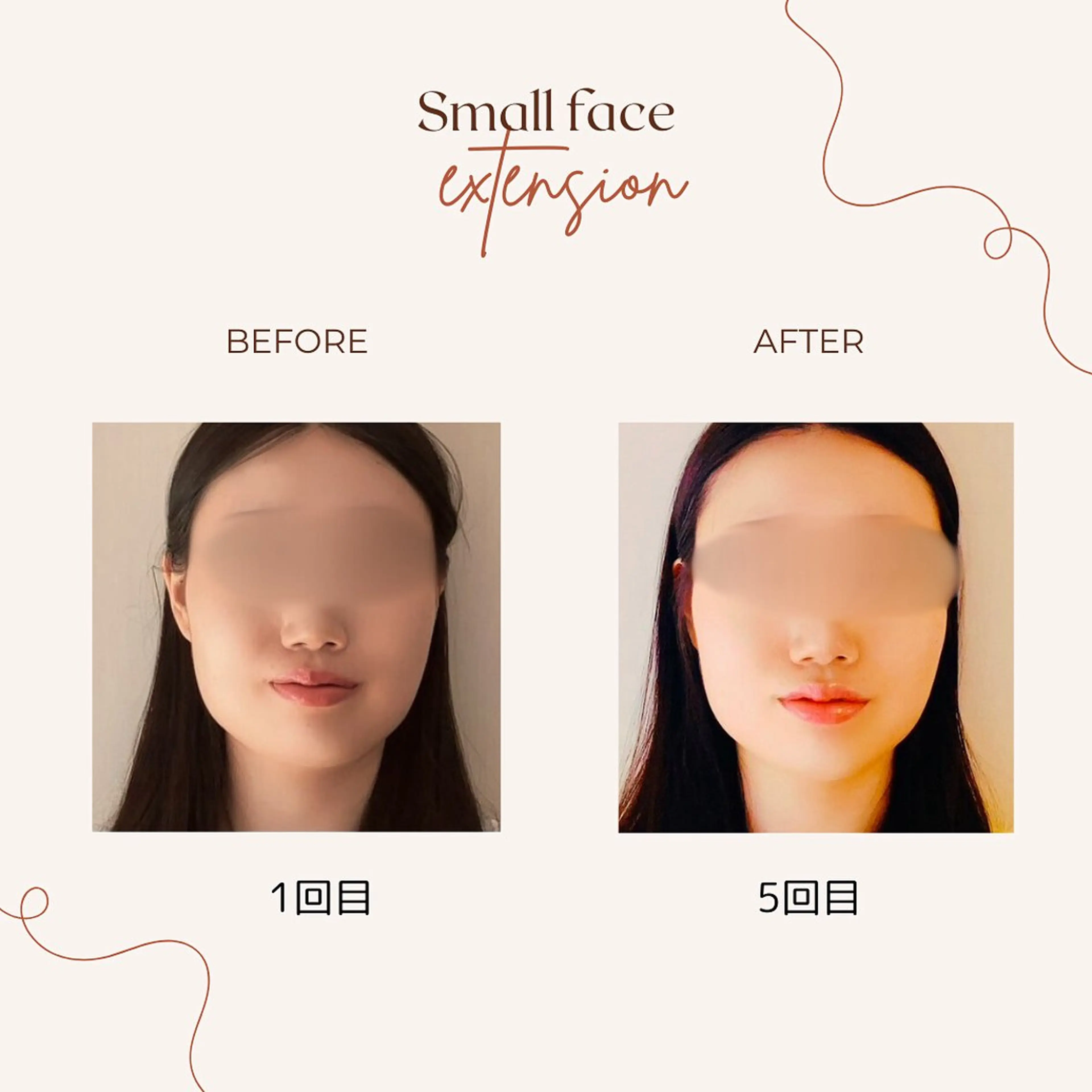 肩こり・腰痛改善専門 1万人以上施術の碧人のエステ・リラクイメージ