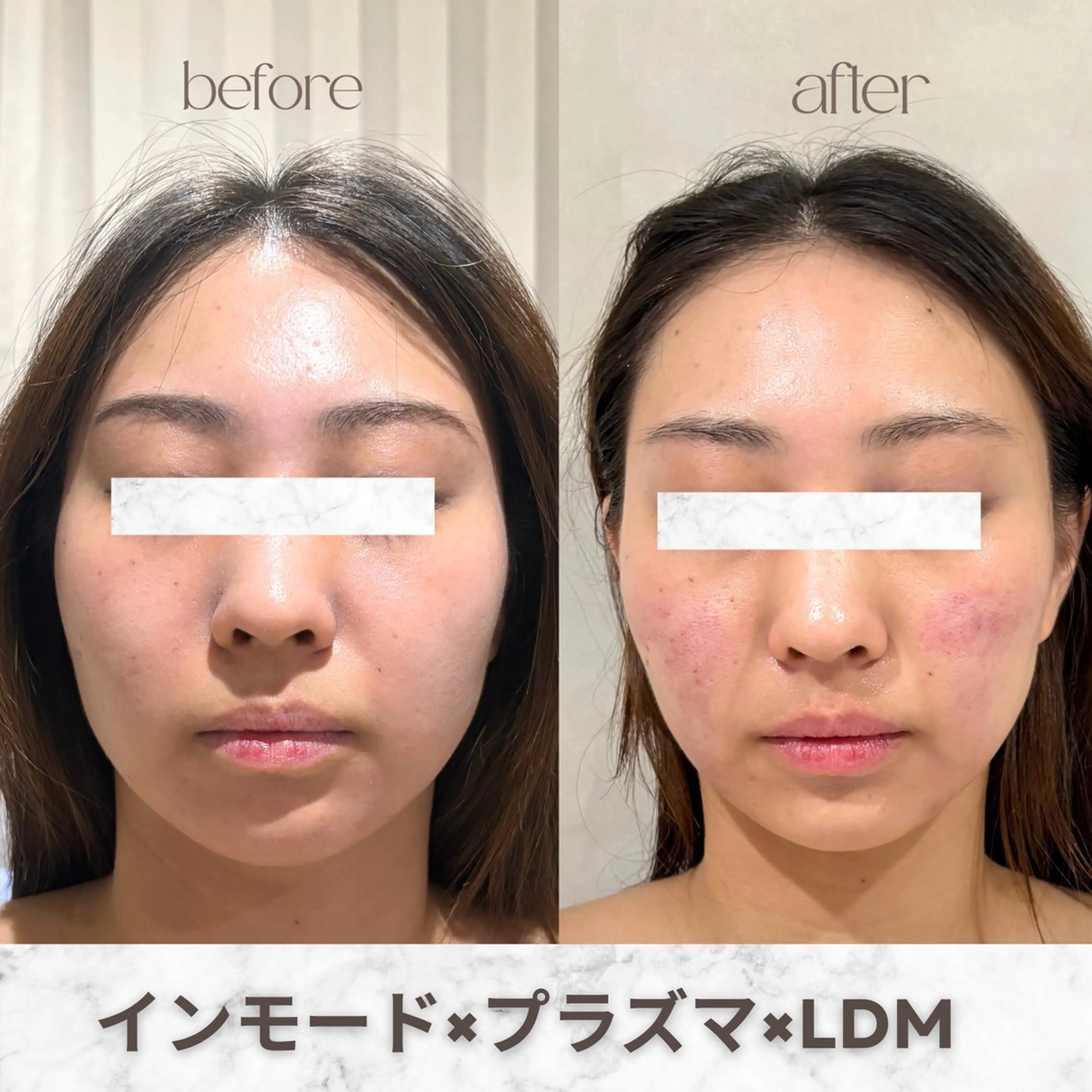 その他 aimer服部 /  小顔 ・ 痩身のその他イメージ