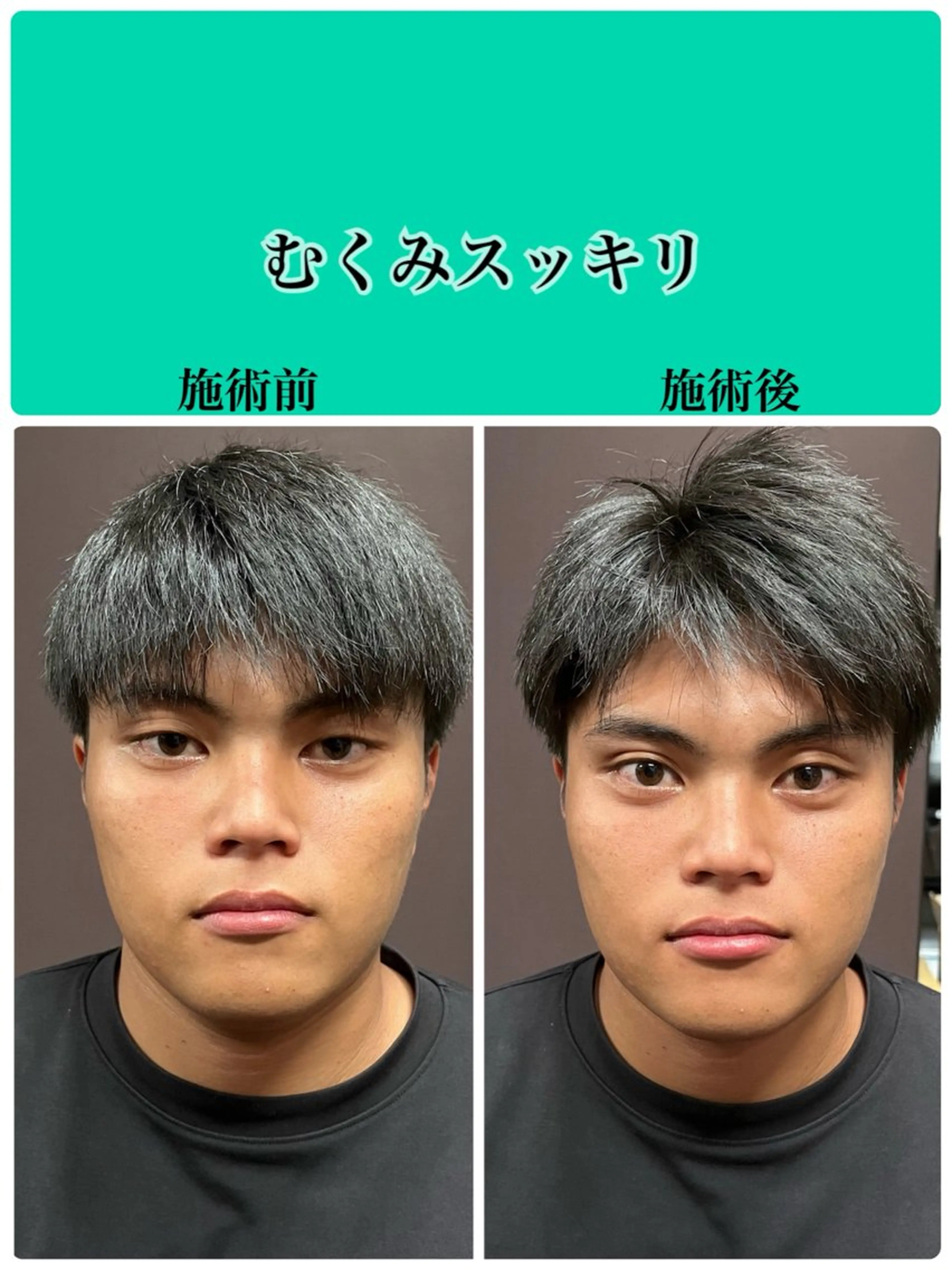 メンズ エステ 安川 むつみのエステ・リラクイメージ