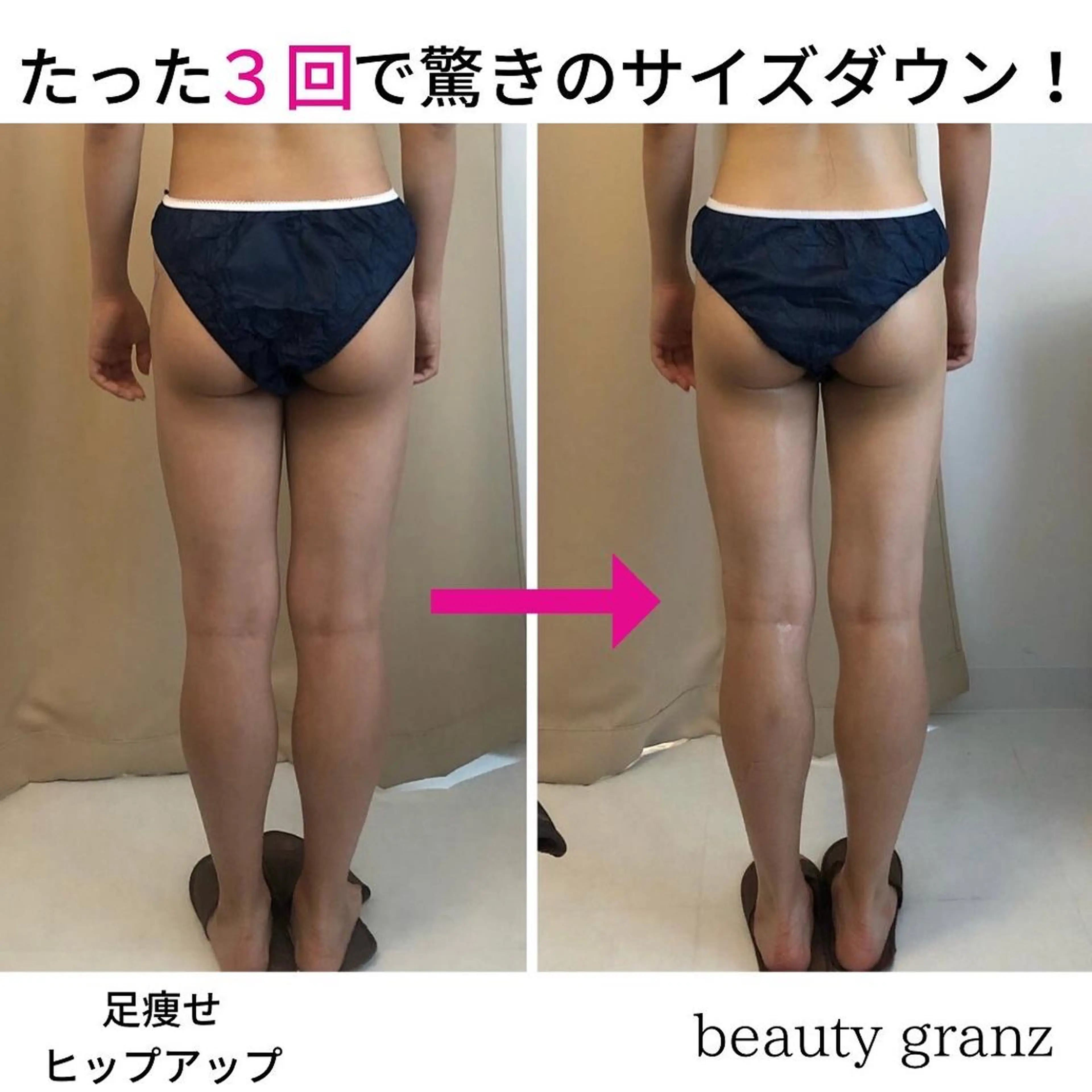 痩身専門サロン ビューティーグランツのエステ・リラクイメージ