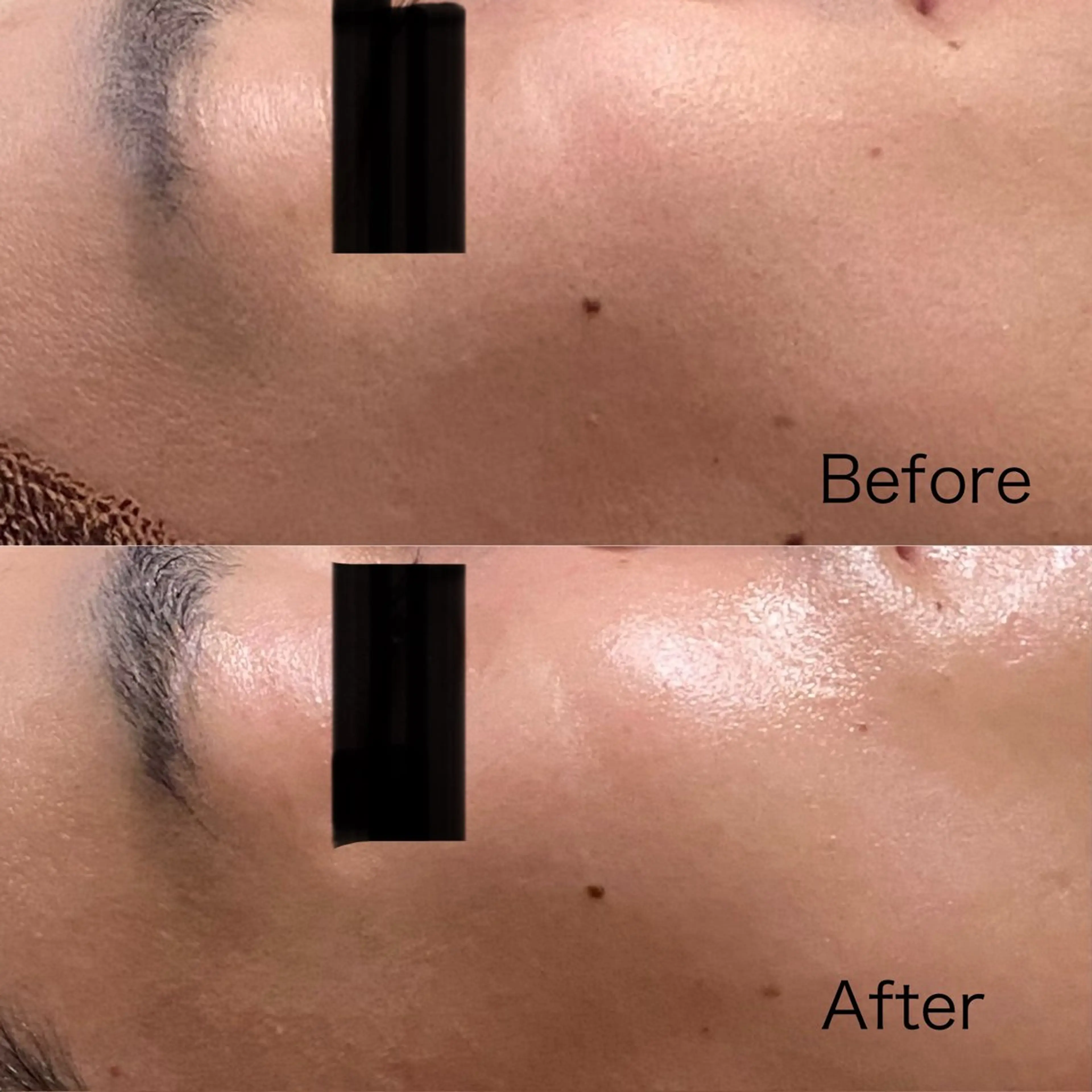 【メンズ】【現金支払いのみ】【小顔フェイシャル】クレンジング付きでぷるぷる肌に♪の写真