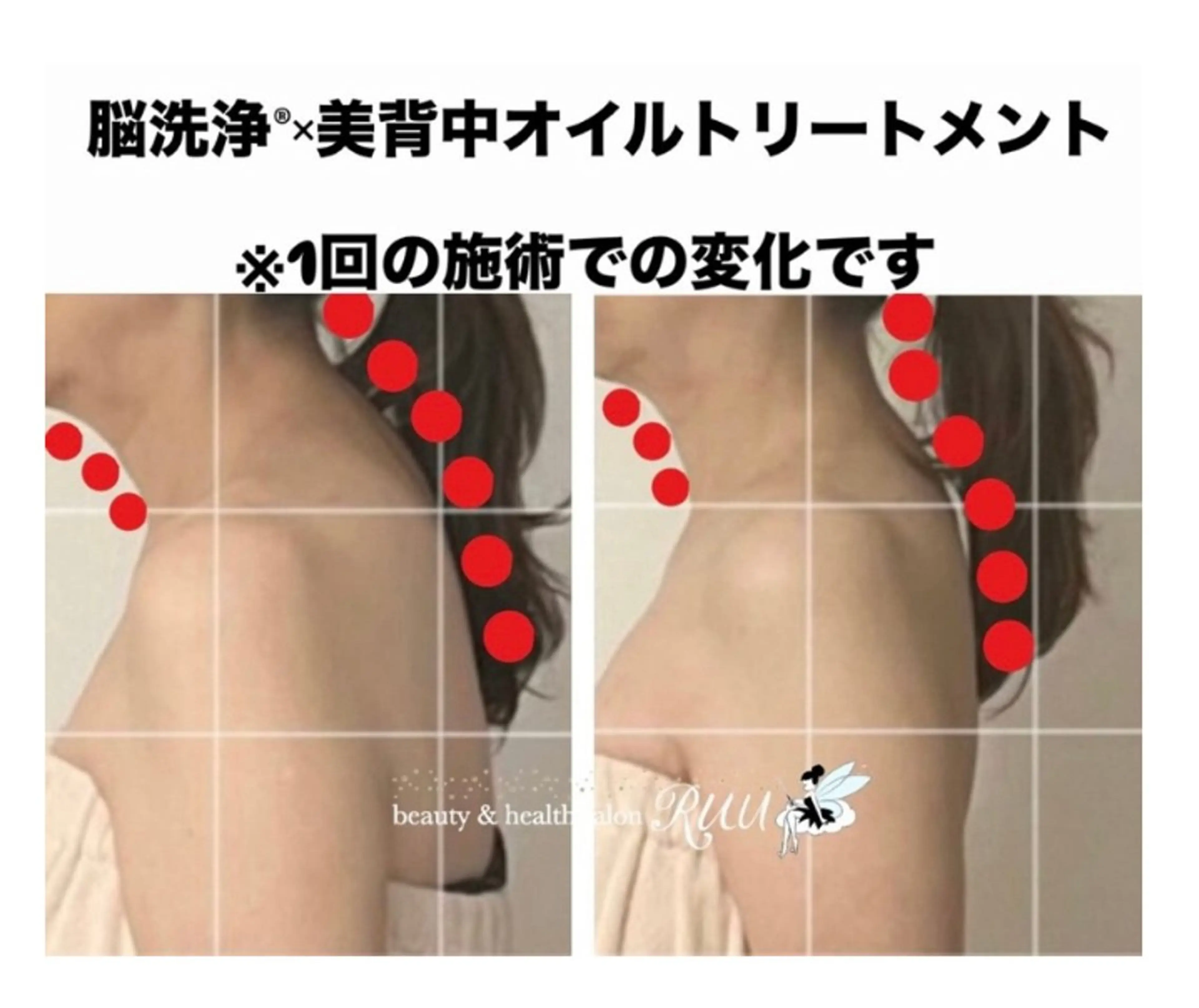 【頭痛、睡眠改善】 salon RUUのエステ・リラクイメージ