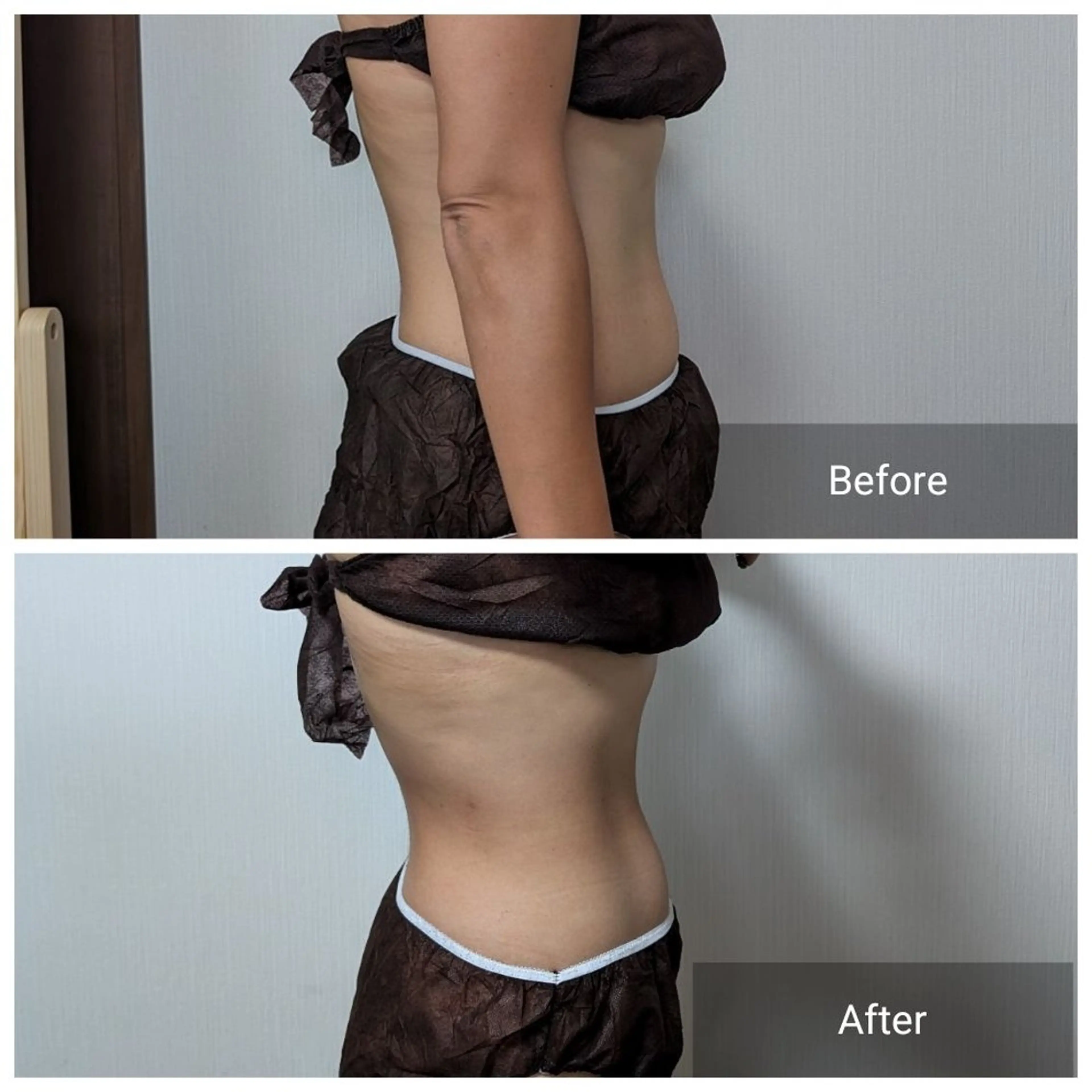 エステ nail RiRi アトレナチュラのエステ・リラクイメージ