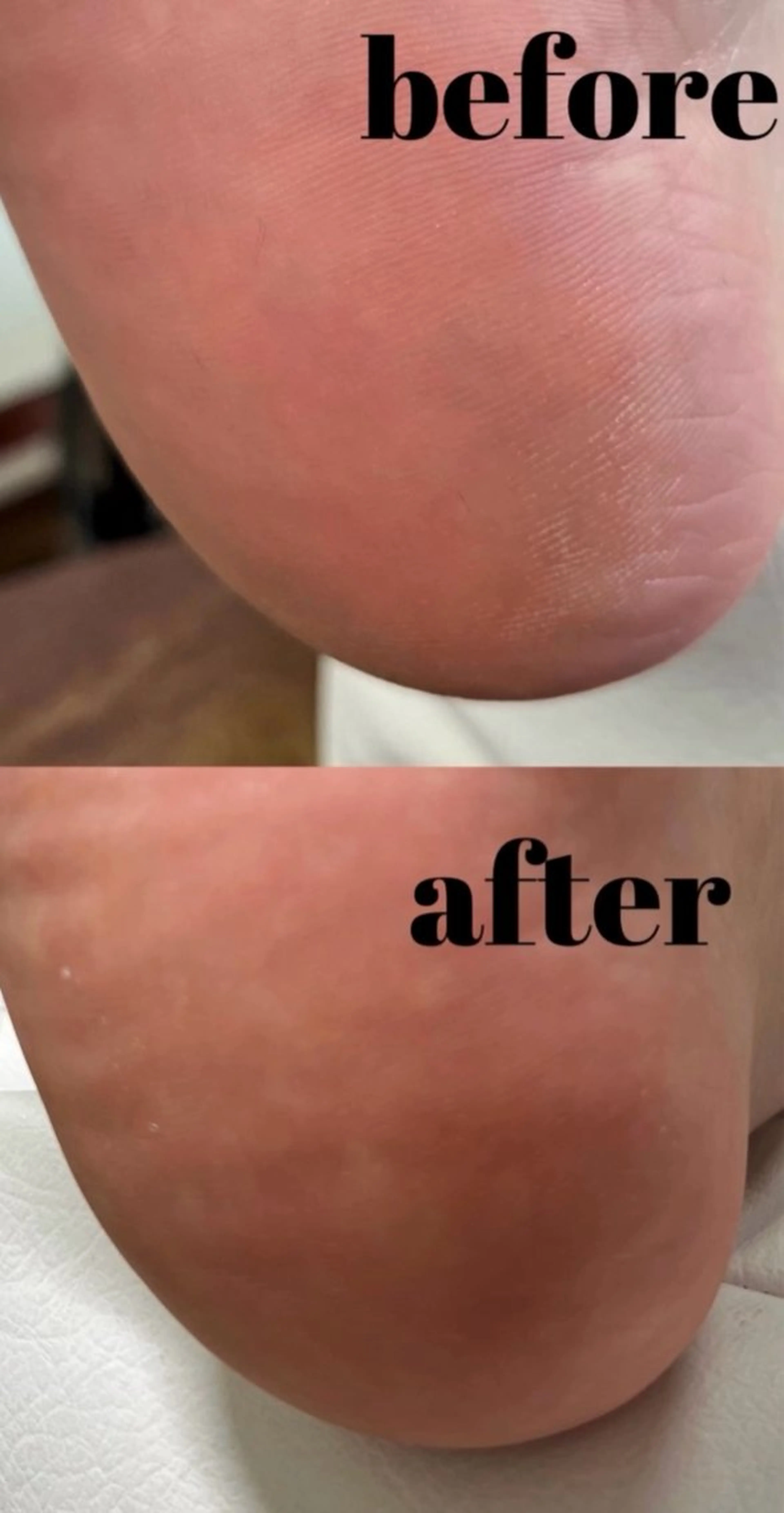 - SpaLuce - スパルーチェ　2026,5/20 START𖤐ˊ˗の写真