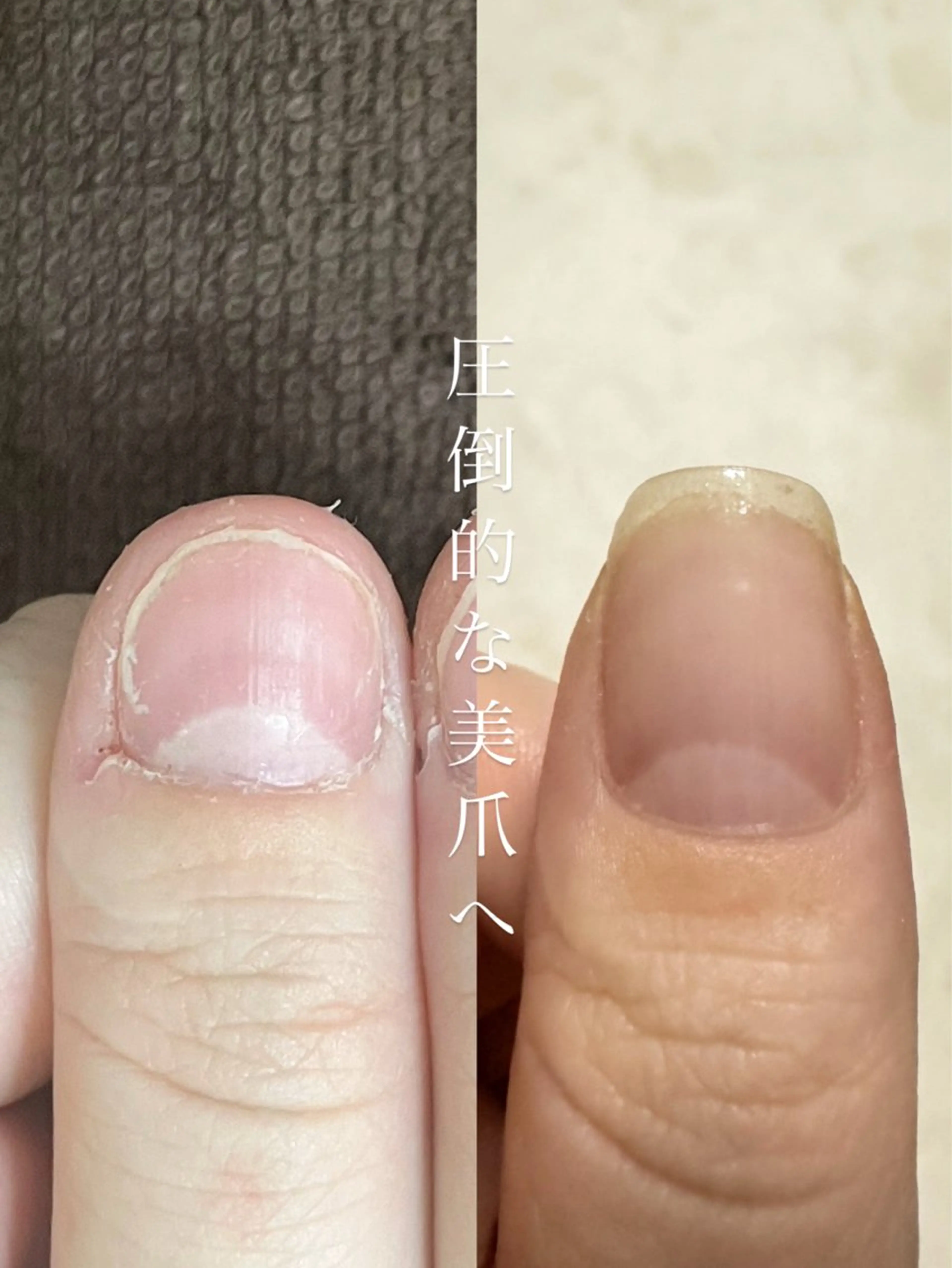 ネイル fote-自爪育成 ネイルケアサロン-のネイルデザイン