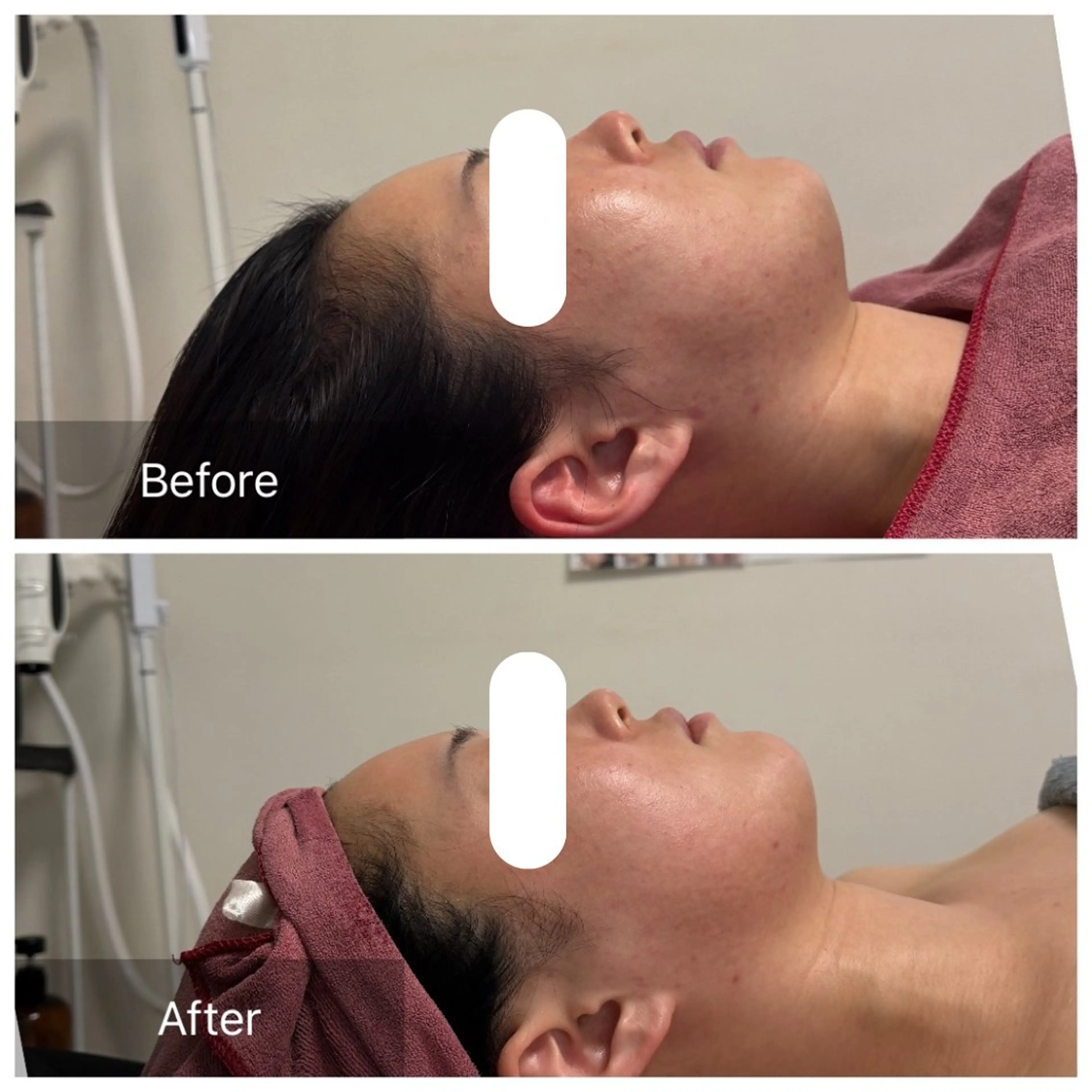 エステ リラク 池田 桃花のエステ・リラクイメージ