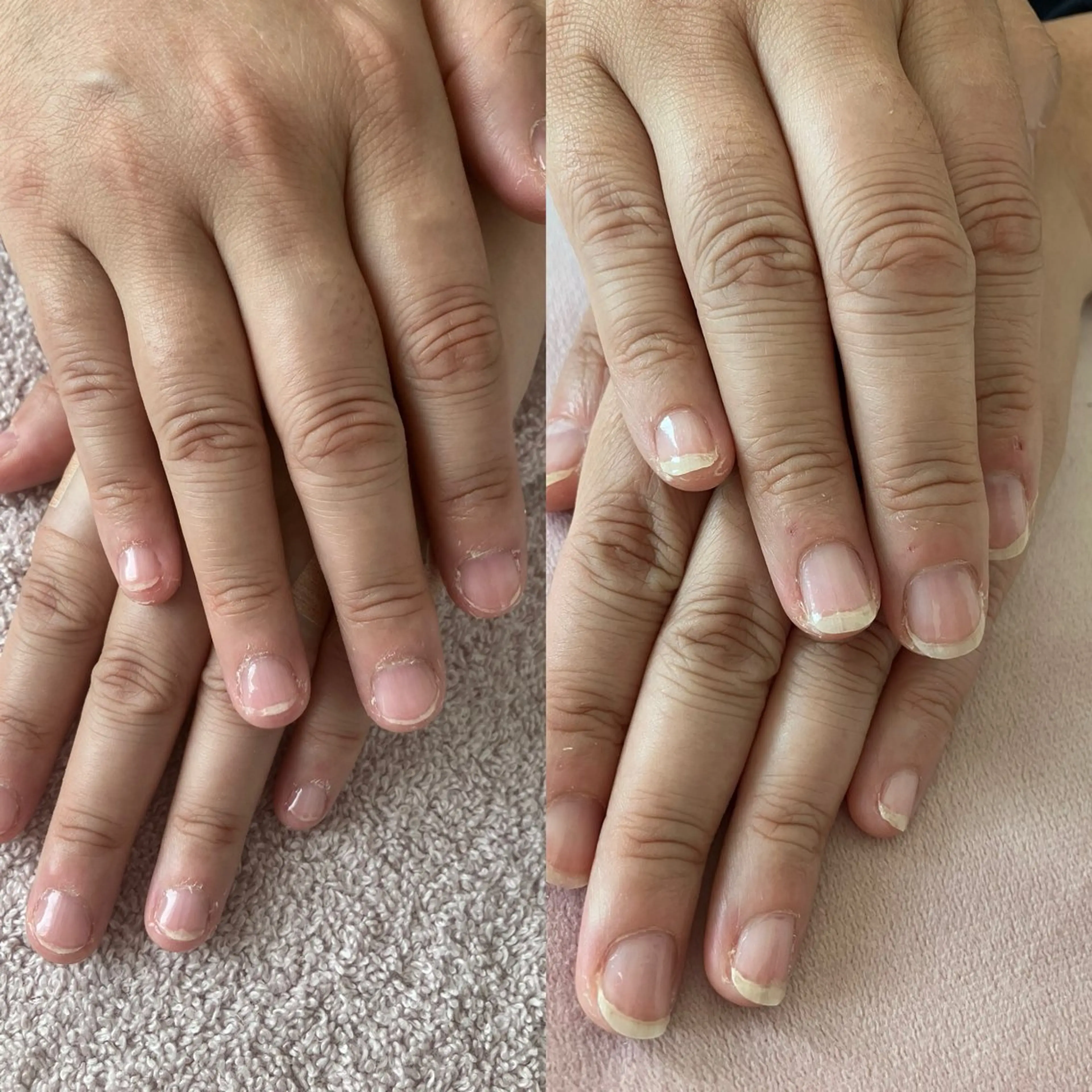 【爪育】男爪に悩む方にオススメ!の写真