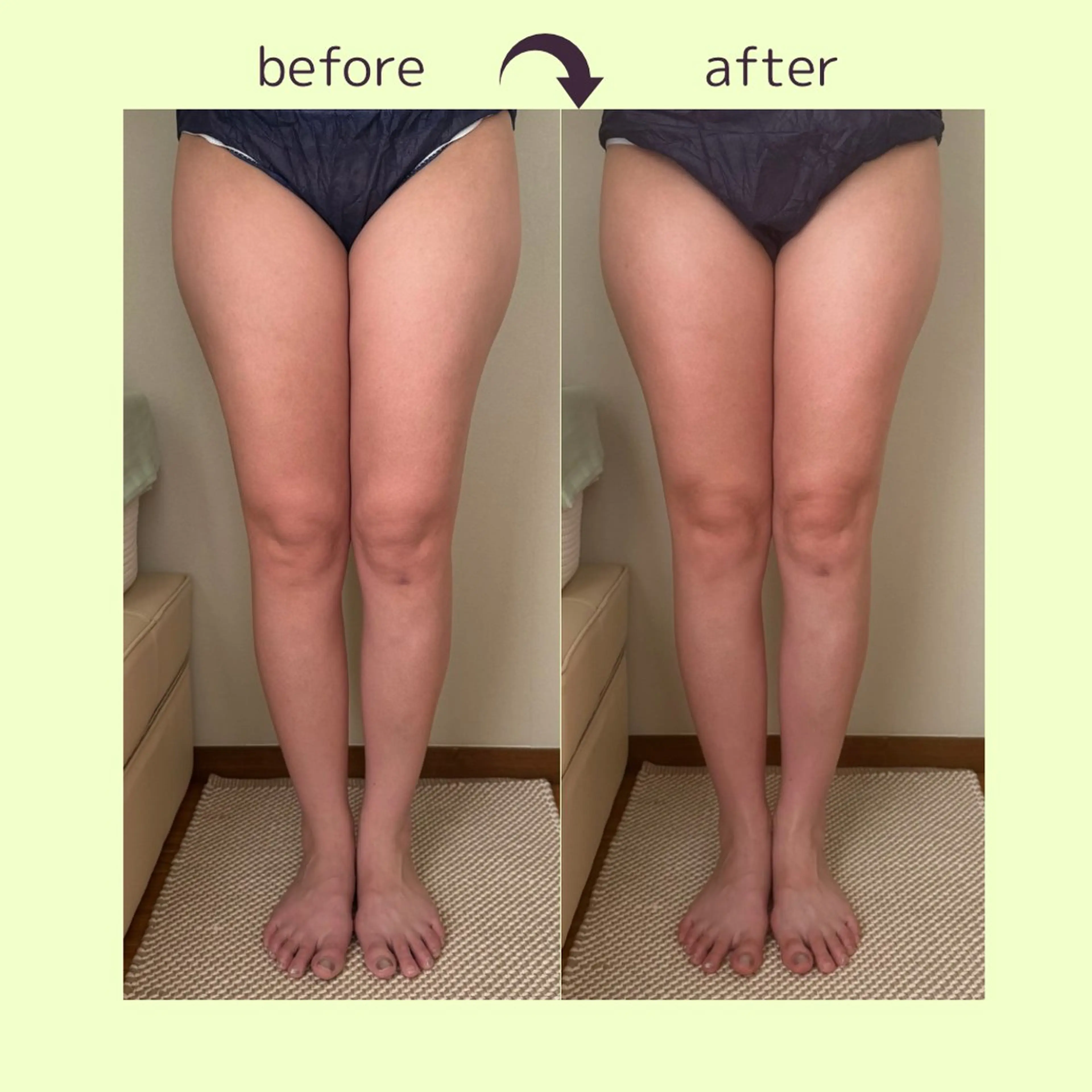 spaHINOKI 【女性専用】のエステ・リラクイメージ