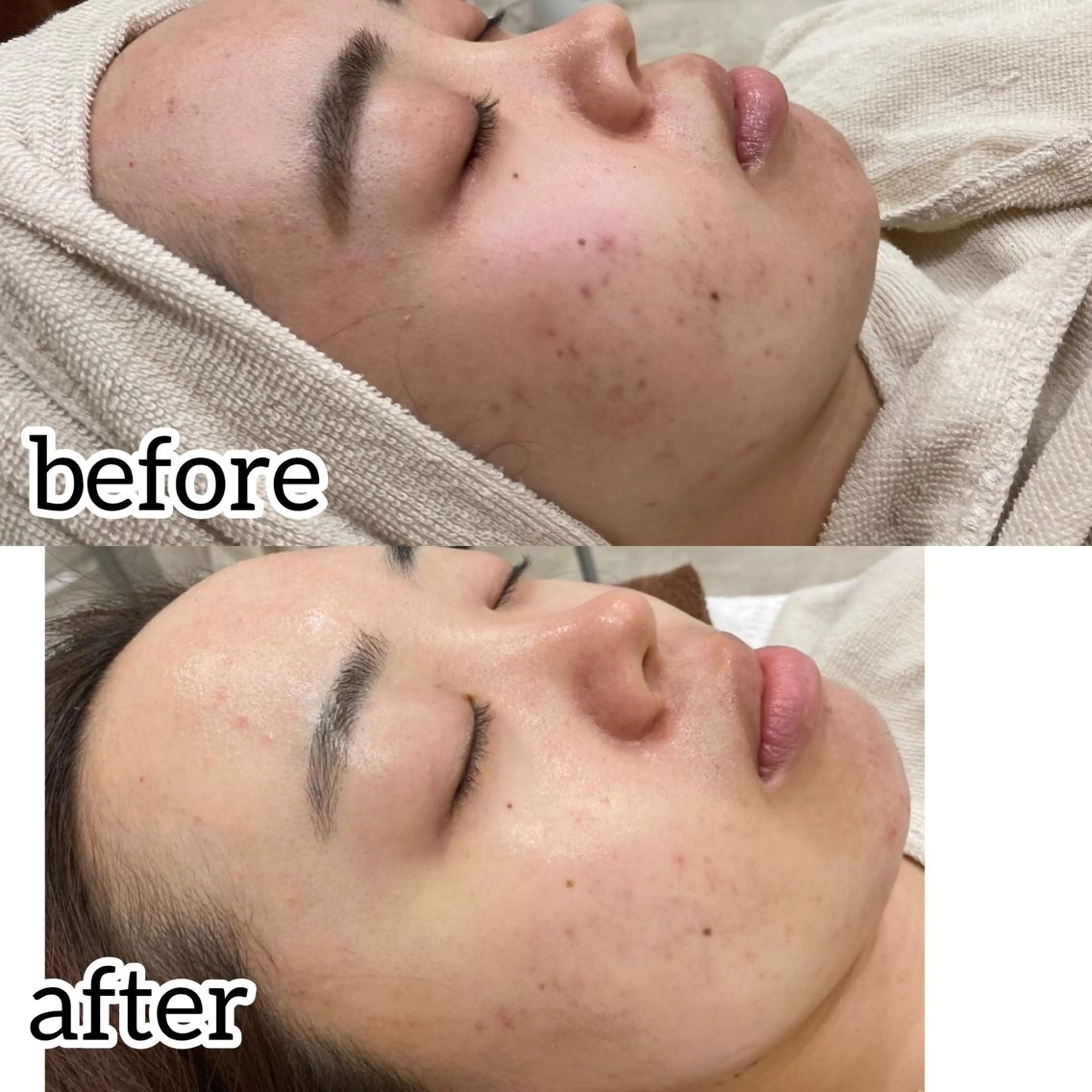 laluna saki...のその他イメージ