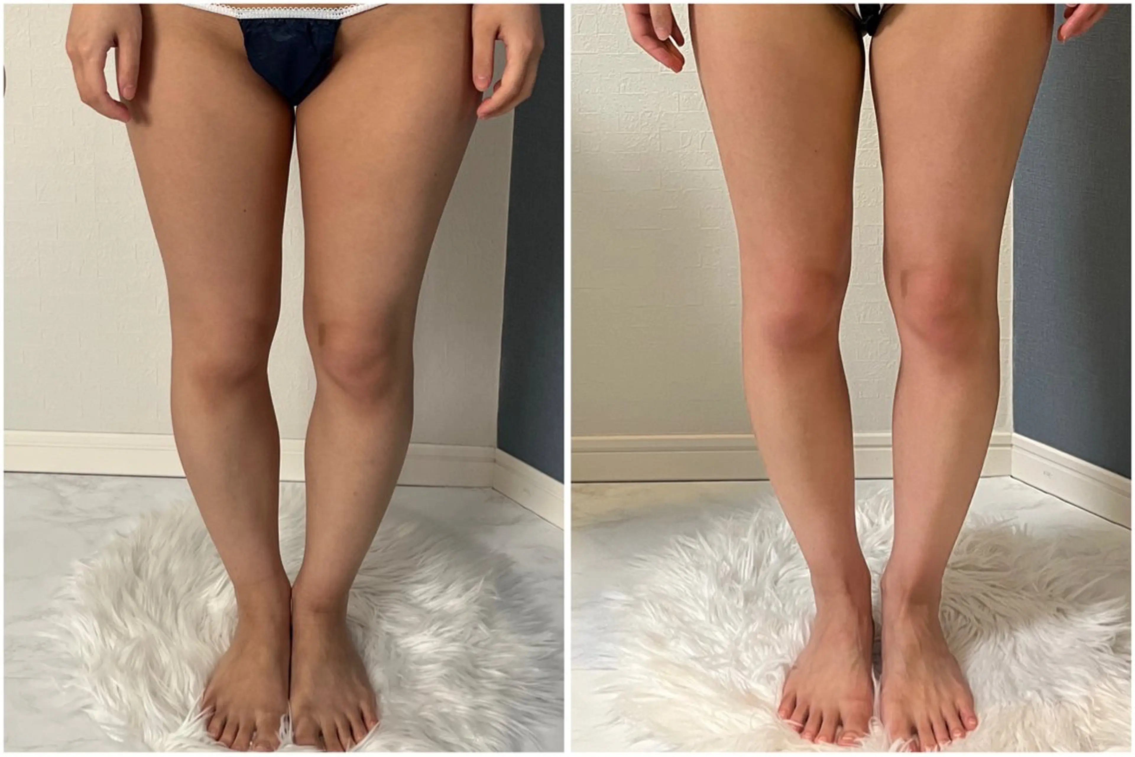 湘南エステサロン moaのエステ・リラクイメージ