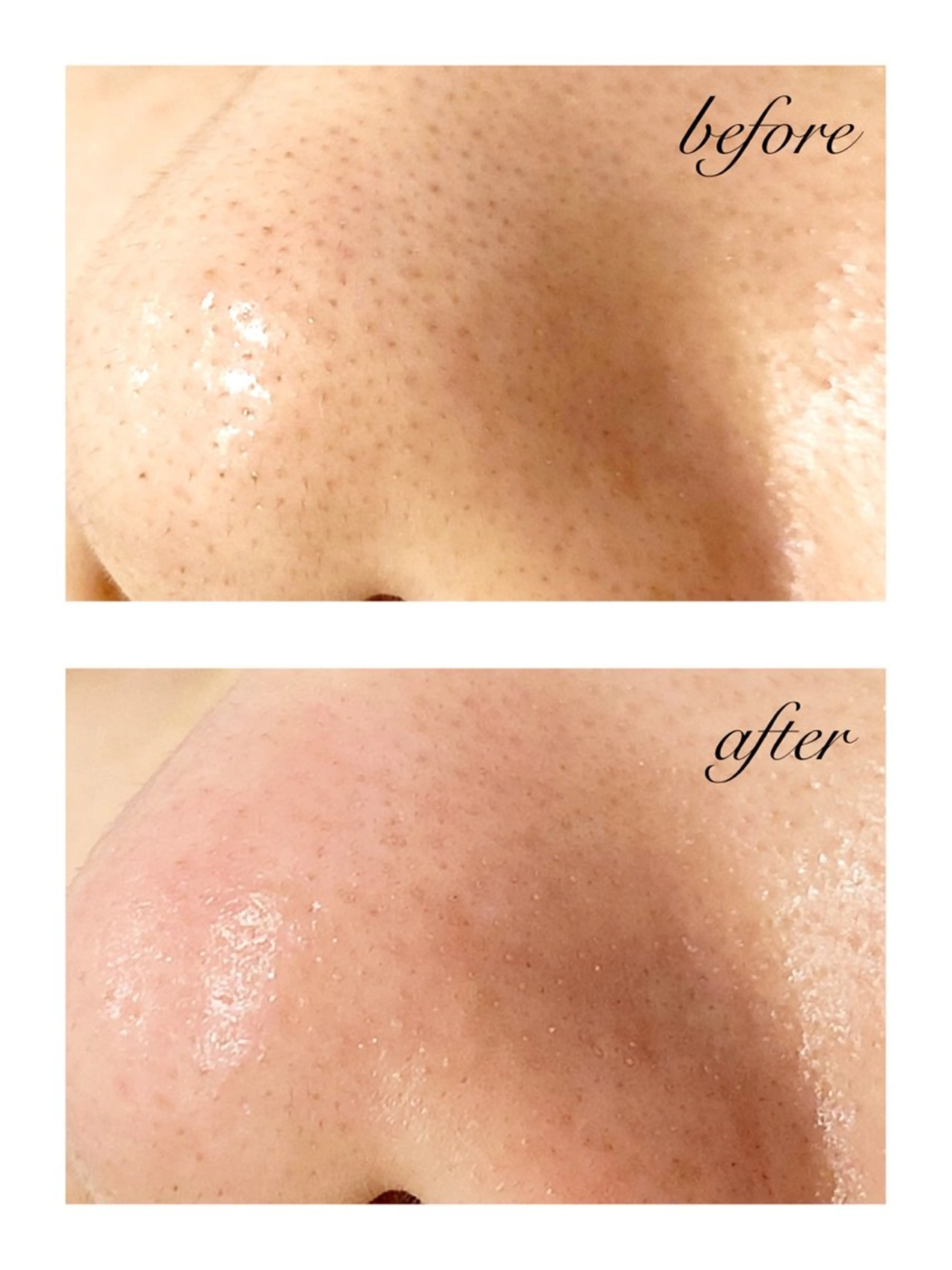 脱毛 Seek lash&browのエステ・リラクイメージ