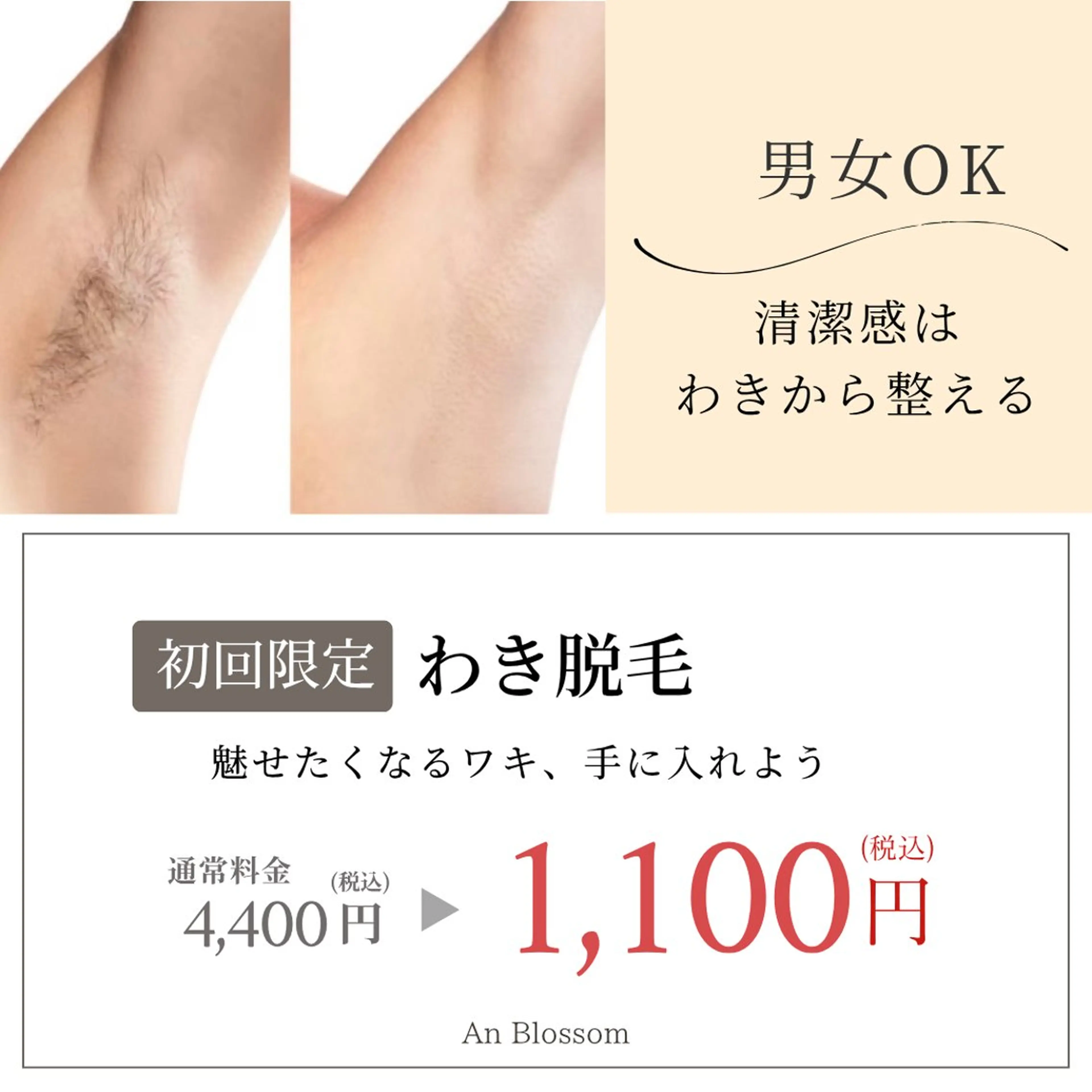 脱毛 An Blossom所属・An Blossom 脱毛/茅ヶ崎/美咲のエステ・リラクイメージ