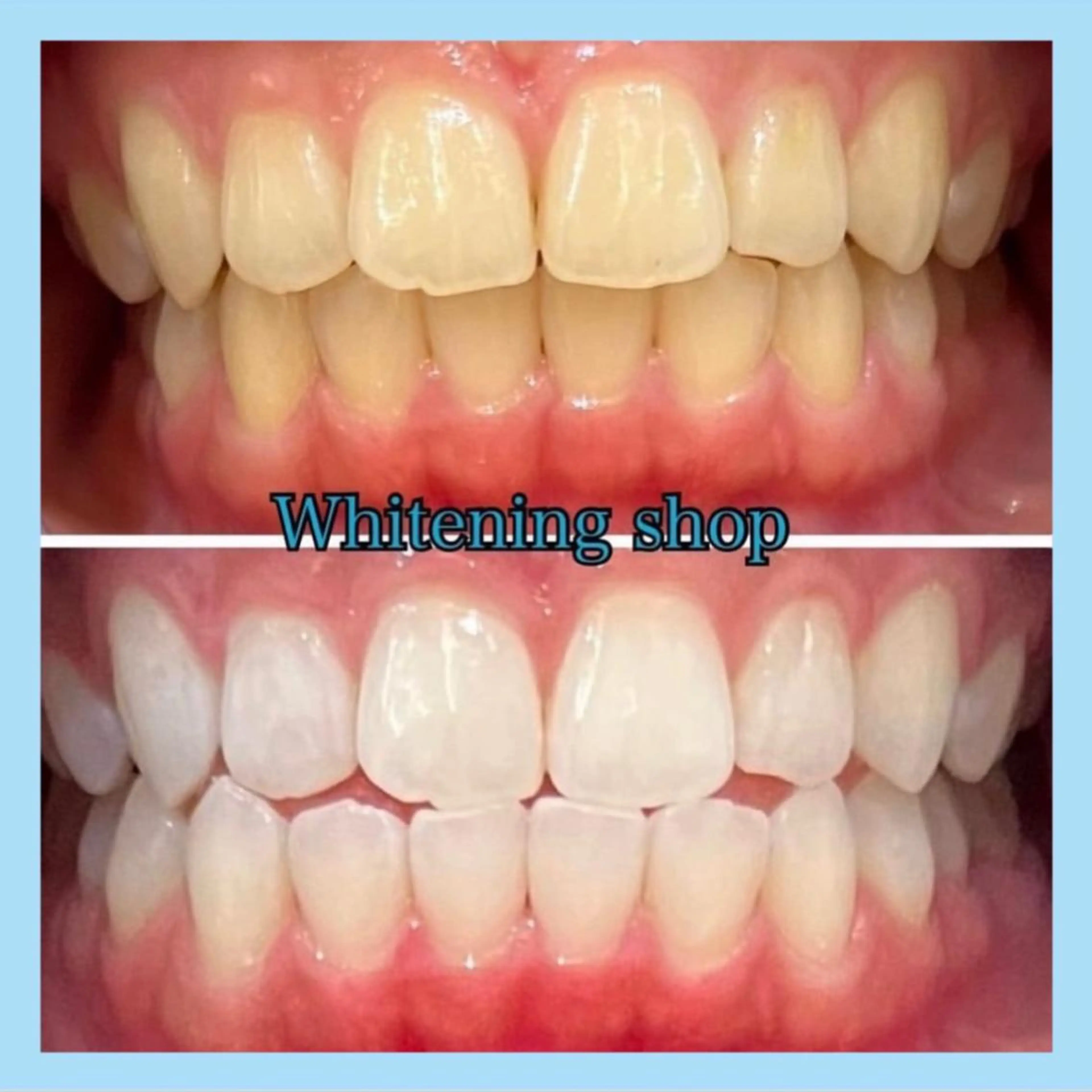 ホワイトニング ショップ千葉店のその他イメージ