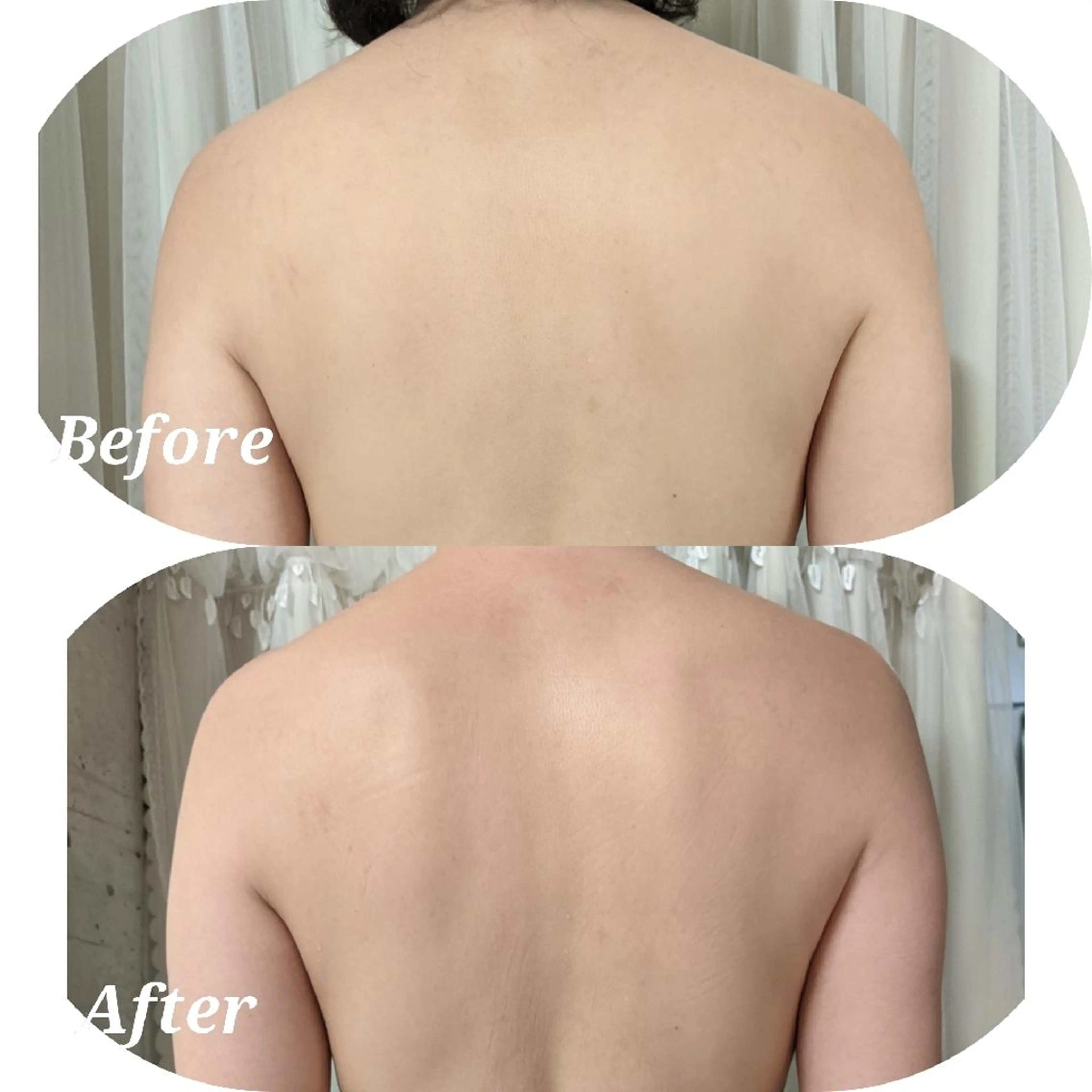 深層リンパオイル/小 顔とドライヘッドスパのエステ・リラクイメージ