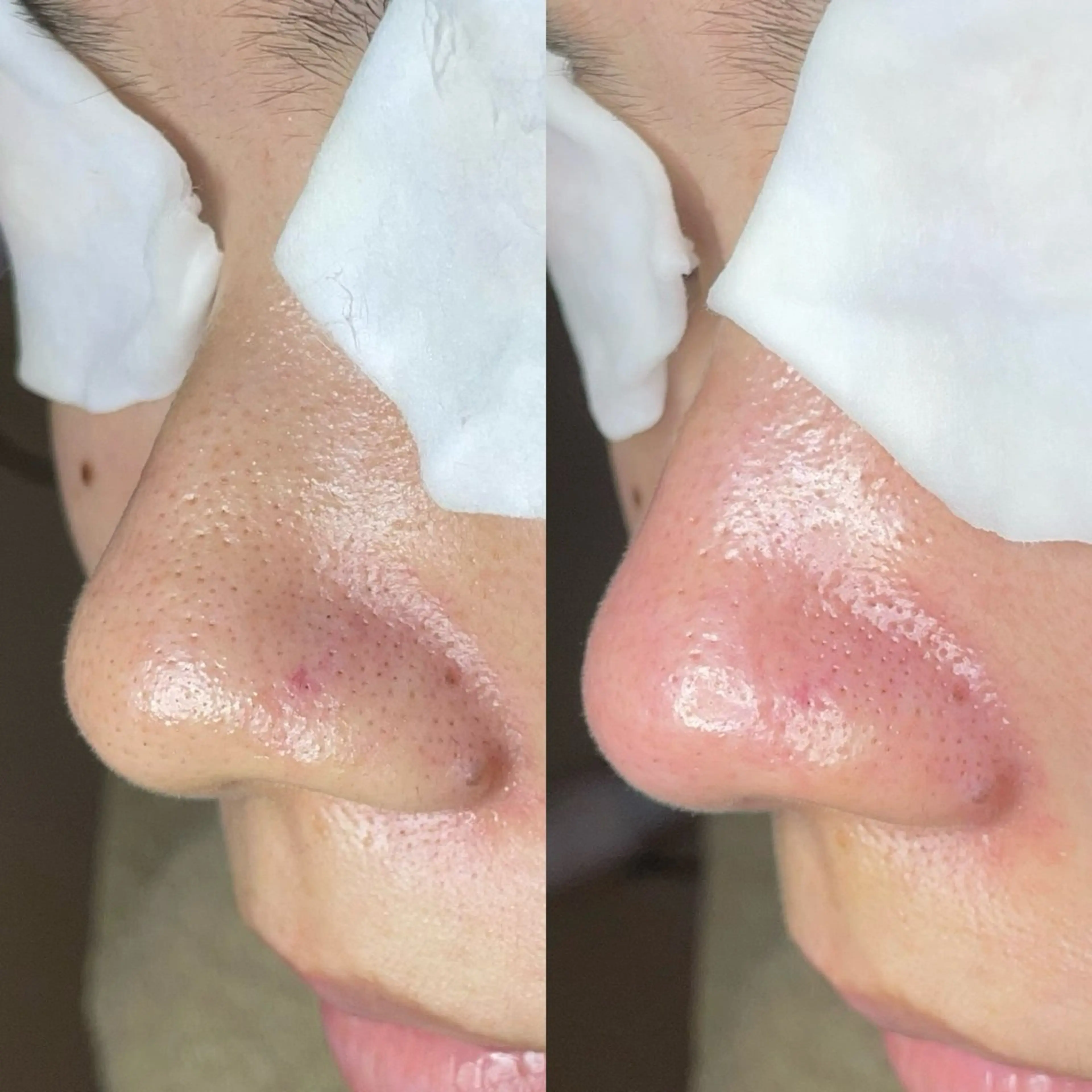 エステ Re:Belle 久留米 : 中島のエステ・リラクイメージ