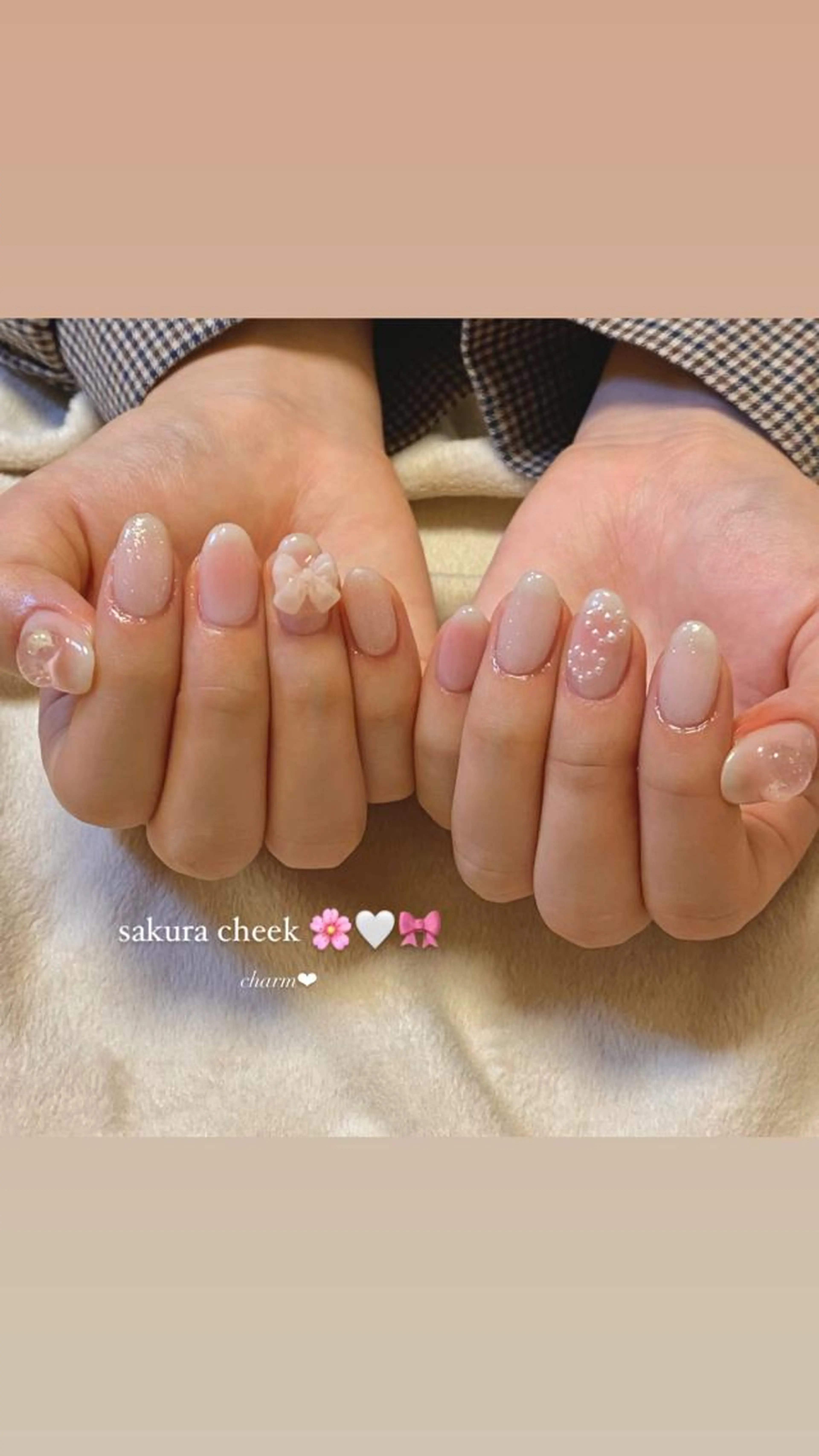 〖ピールオフ〗 アート3本 (オフ・ケア込 / 他店オフOK)の写真