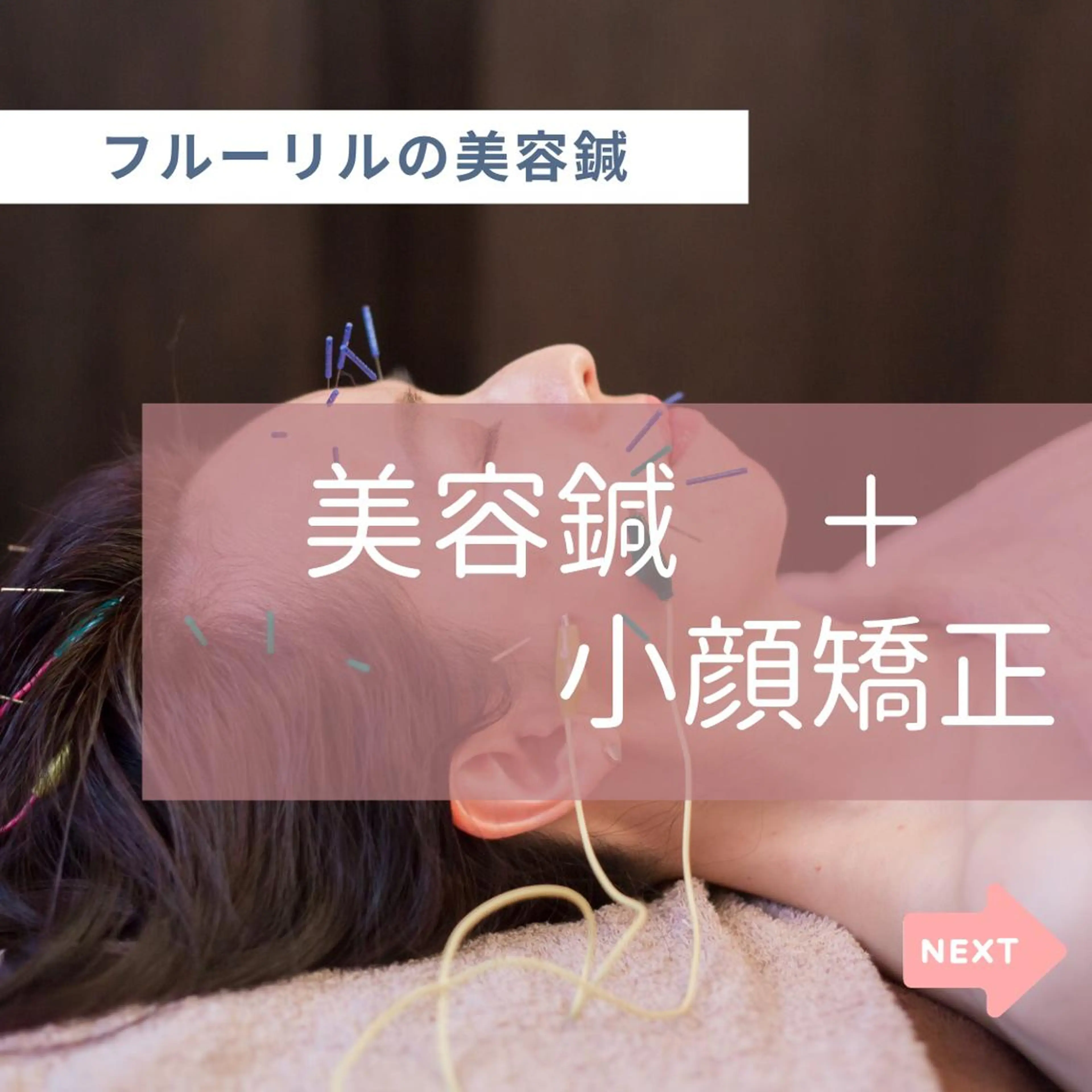 美容鍼サロン    Fleurir所属・伊藤 かなえのエステ・リラクイメージ