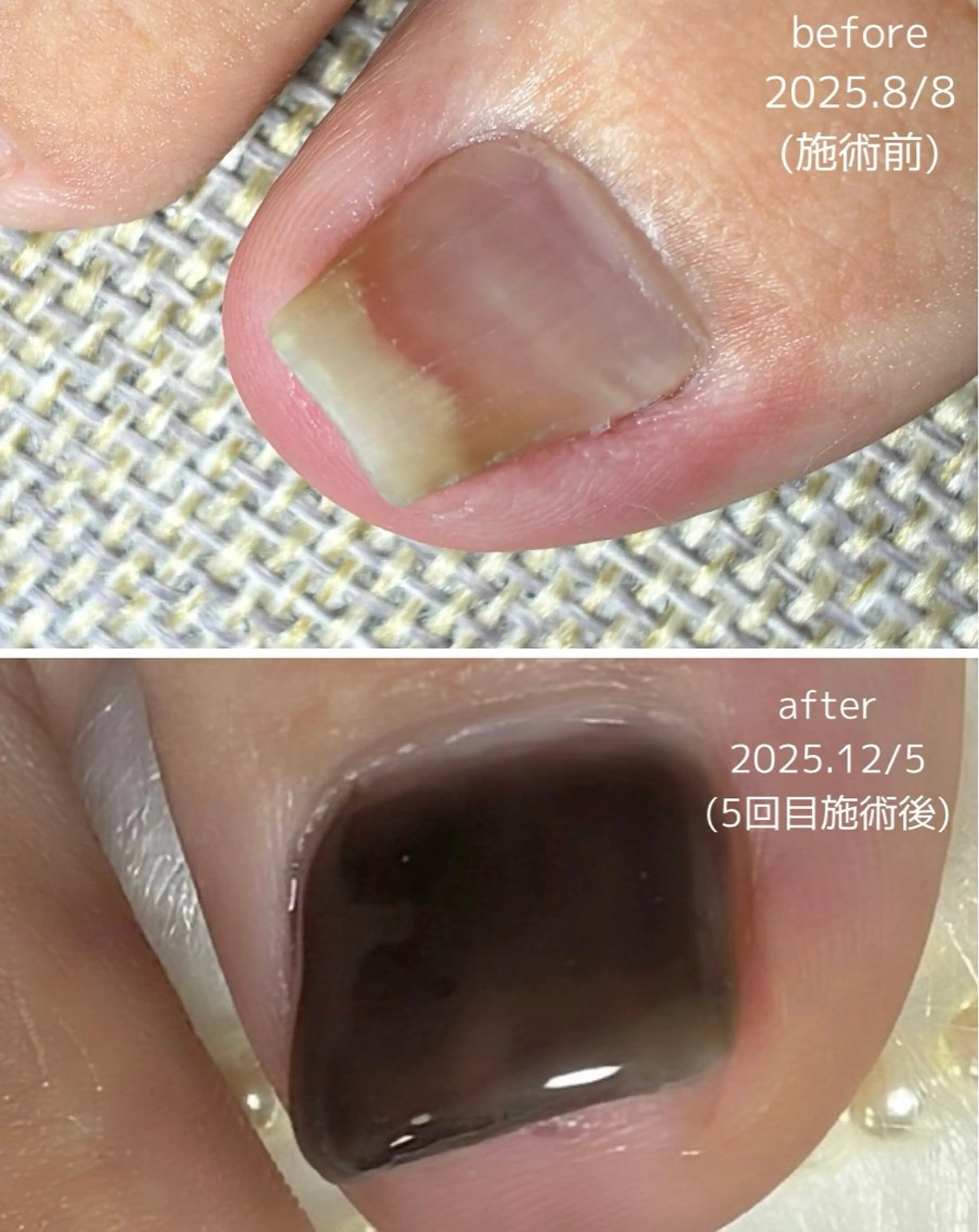 ネイル Li.m nail リム ネイルのネイルデザイン