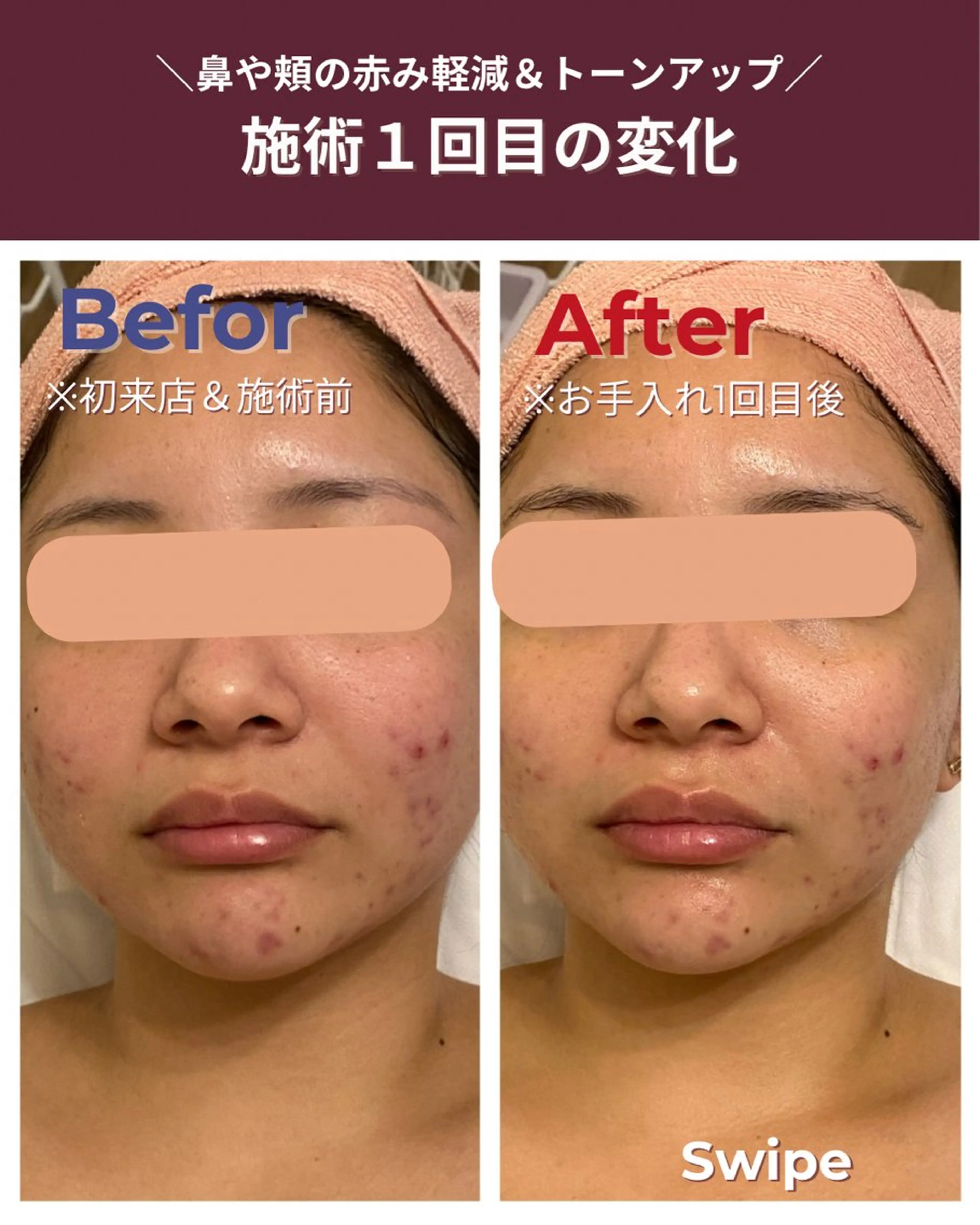 エステ 肌質改善エステ RISMINのエステ・リラクイメージ