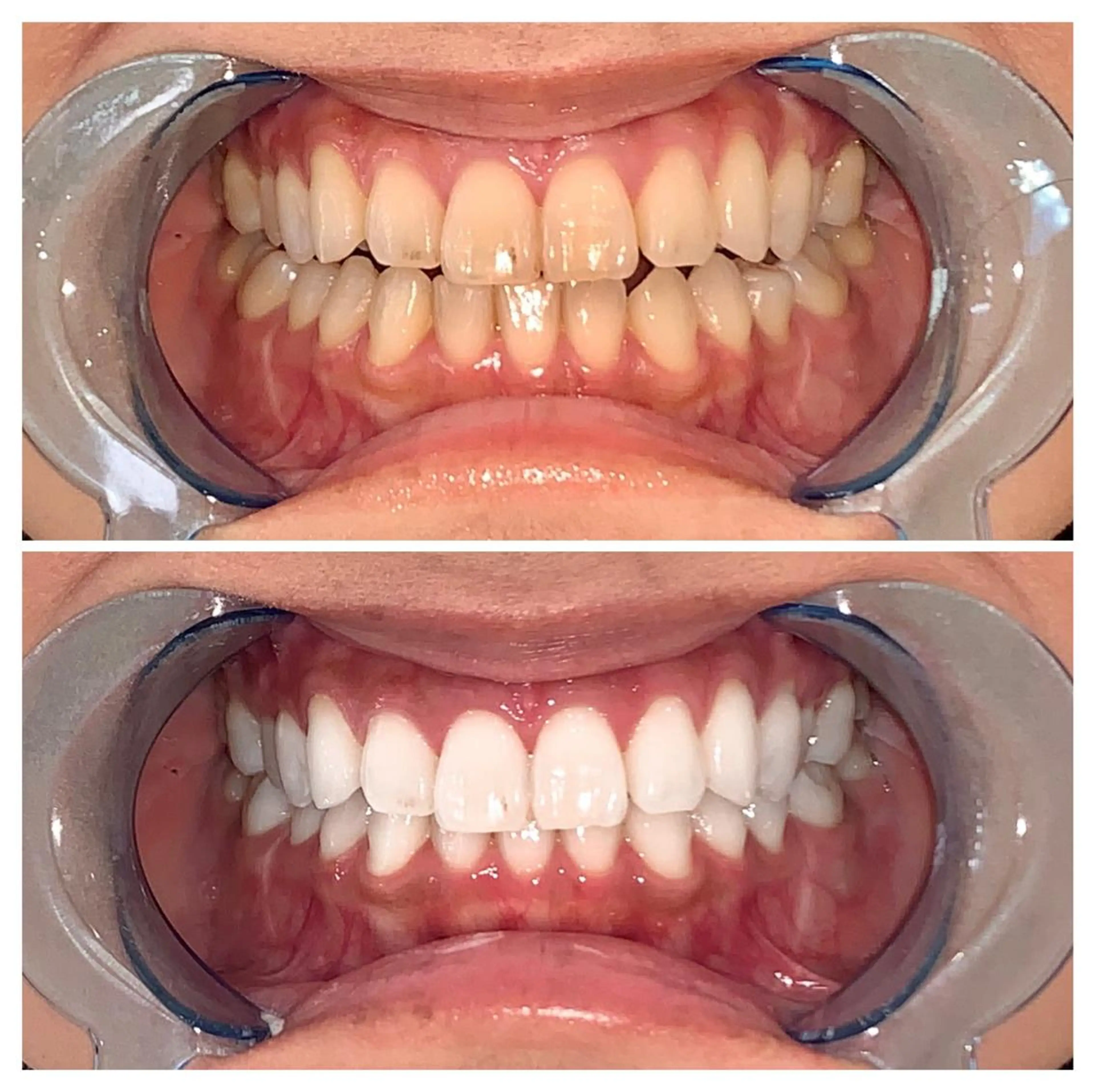 メンズ ライトビューティー 錦糸町店のエステ・リラクイメージ