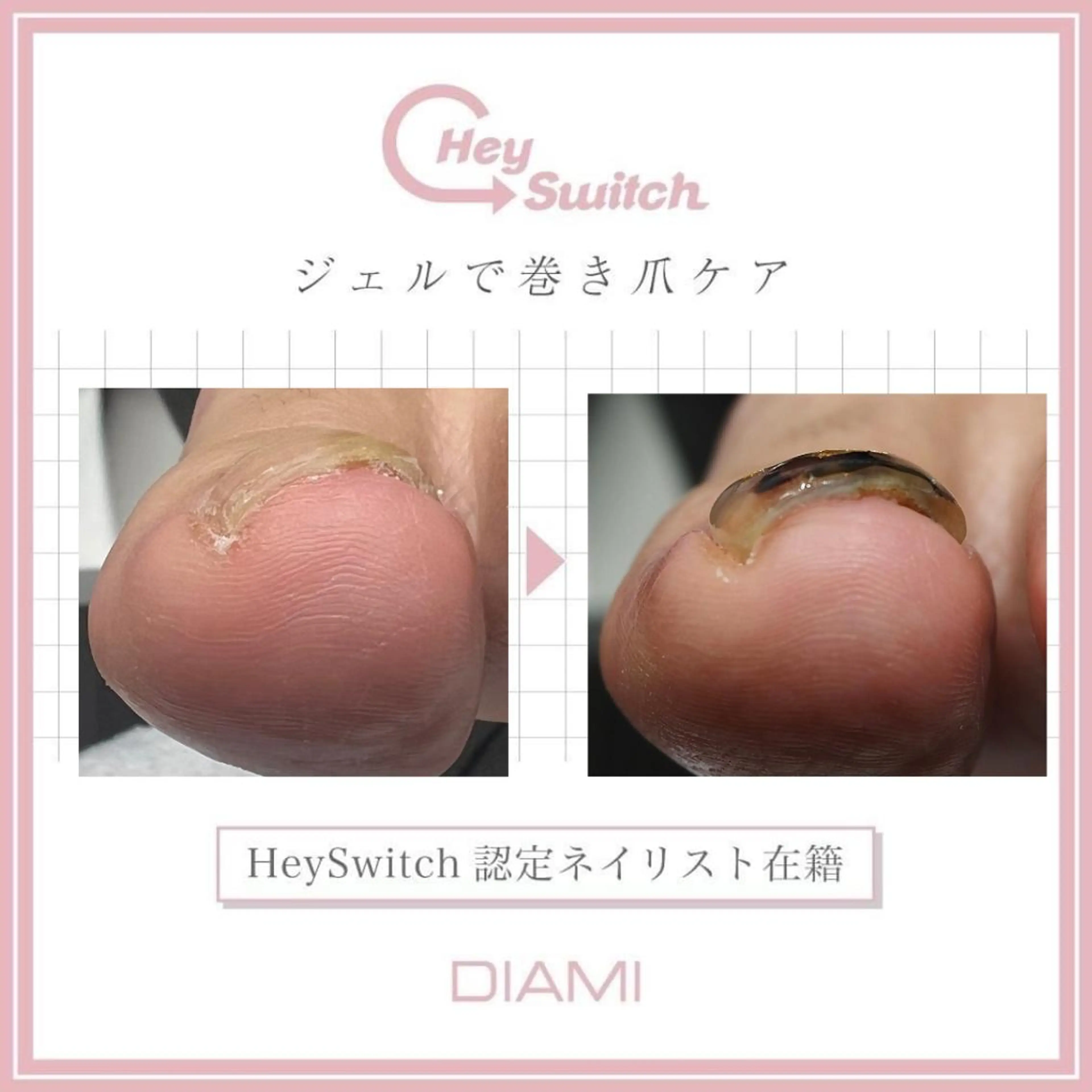 ネイル フットネイル Gatto(ガット) ヤマモトのネイルデザイン